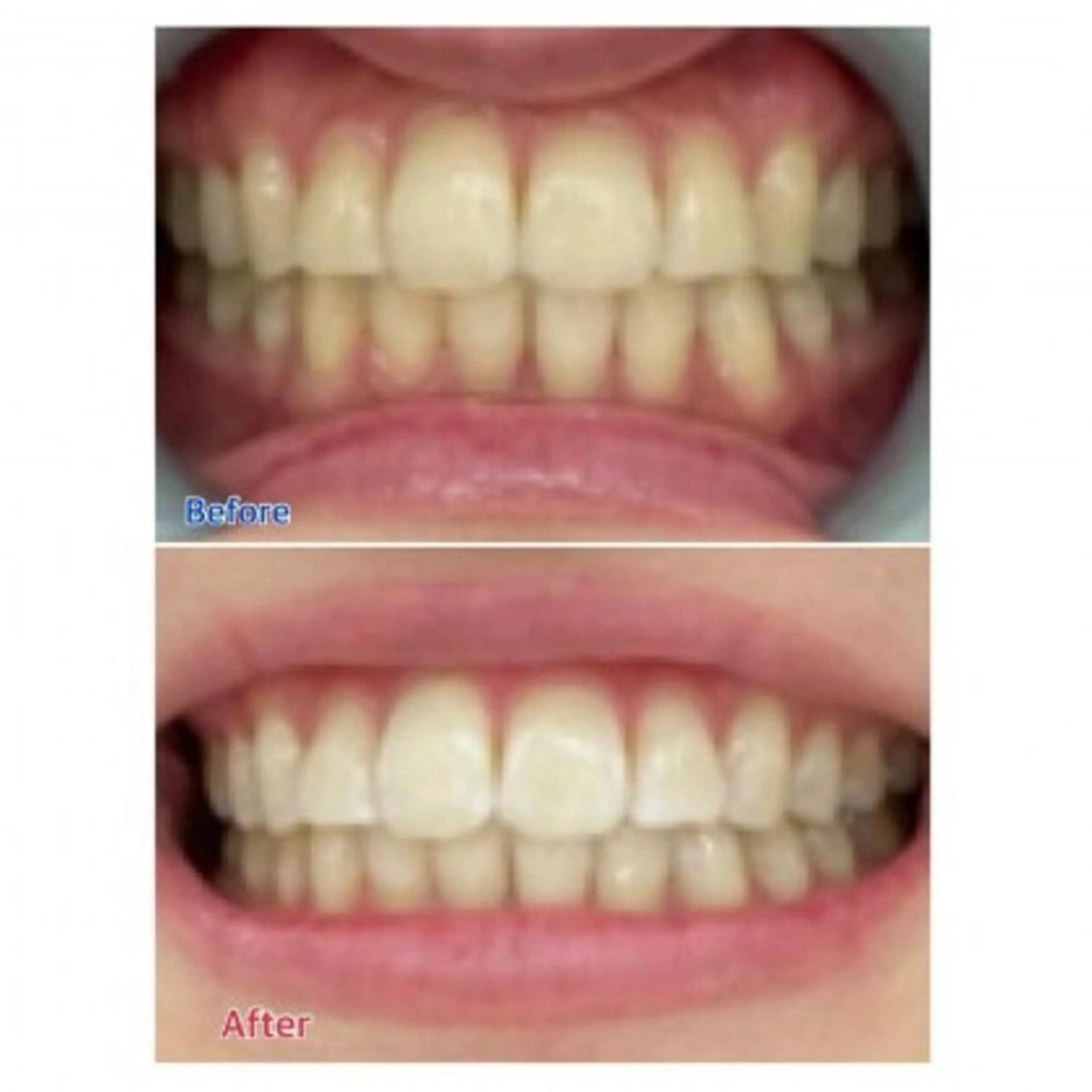 M渋谷店所属・Ｍ渋谷 ホワイトニングのエステ・リラクイメージ