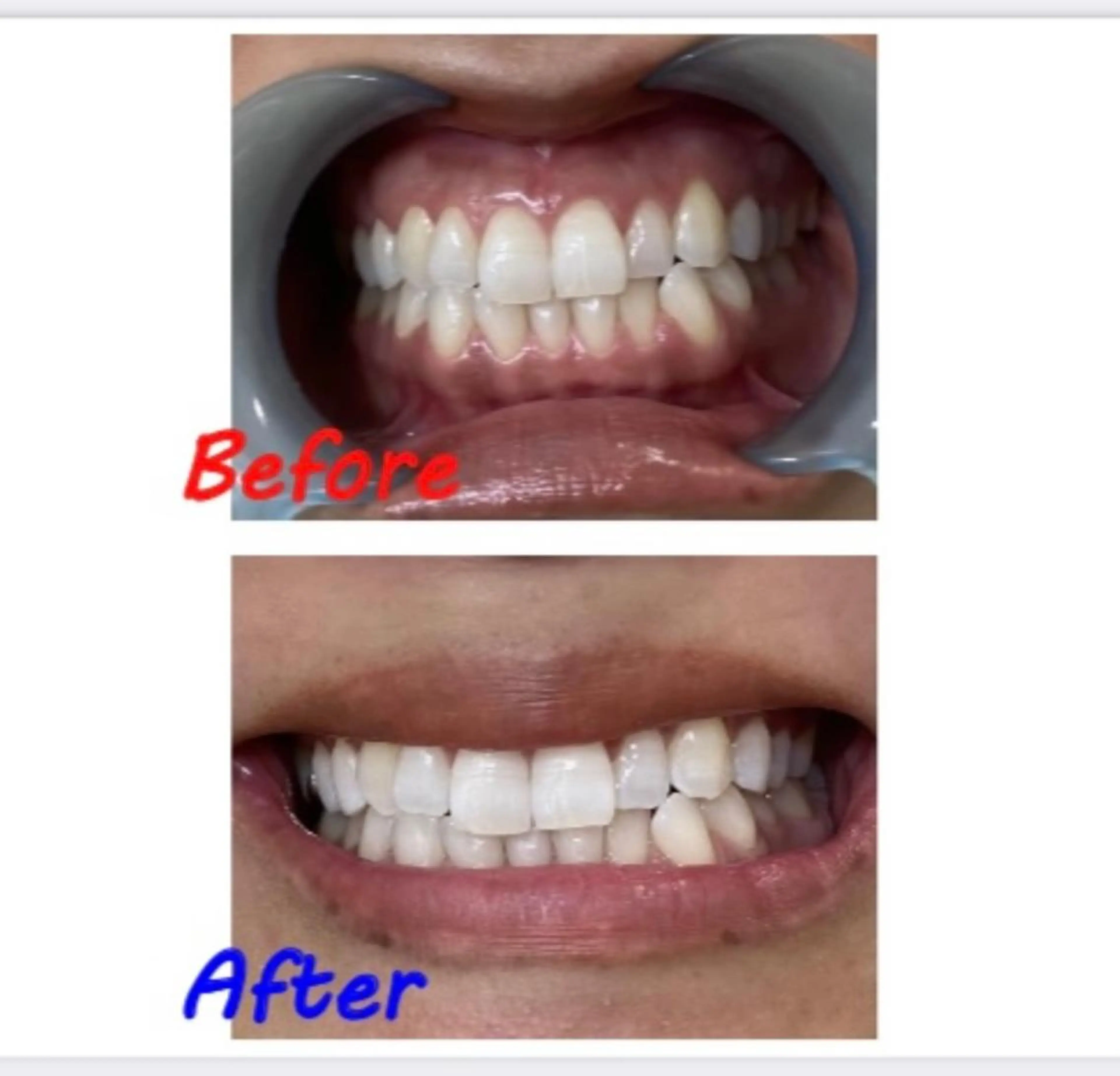 その他 セルフホワイトニングサロン　ラヴィアン所属・ホワイトニングサロン La vie enのその他イメージ