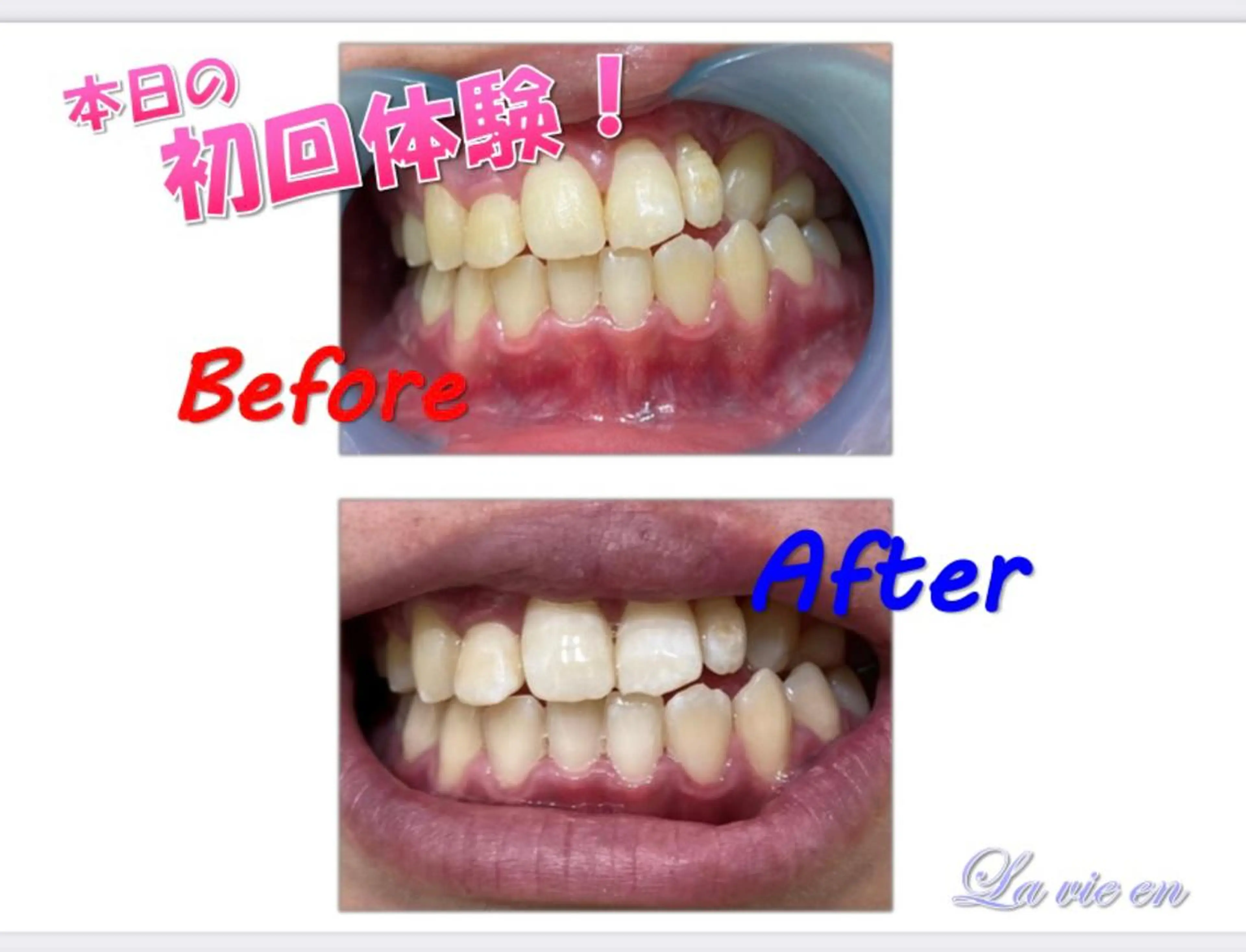 その他 セルフホワイトニングサロン　ラヴィアン所属・ホワイトニングサロン La vie enのその他イメージ