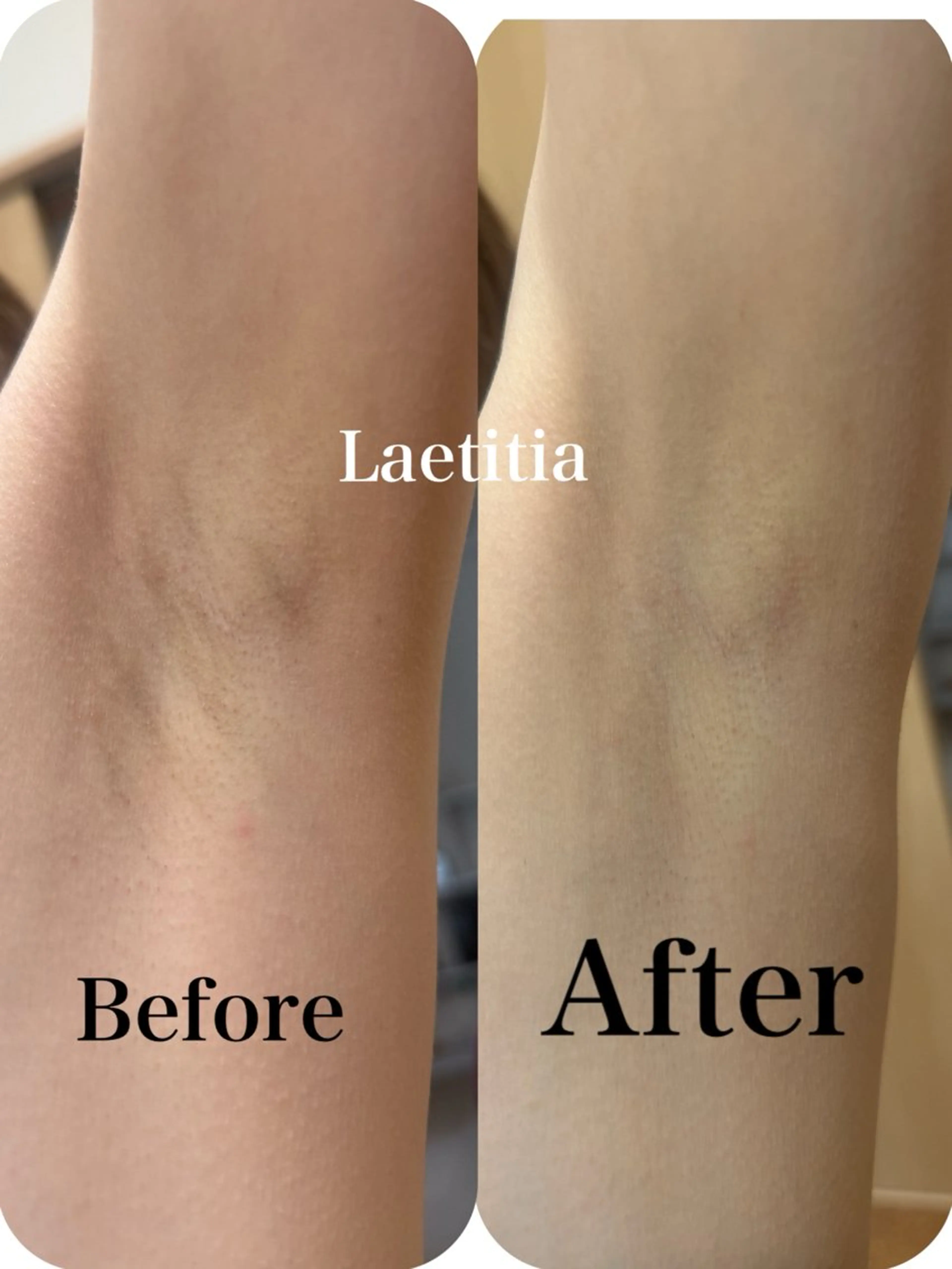 レティティア【Laetitia】所属・レティティア秋葉原店 Yoshizawaのエステ・リラクイメージ