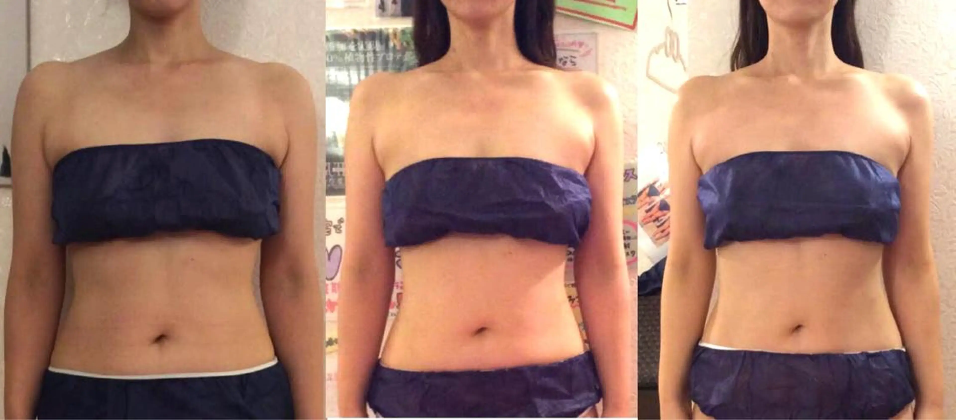 エステ リラク Diamedel所属・柴田 知里のエステ・リラクイメージ