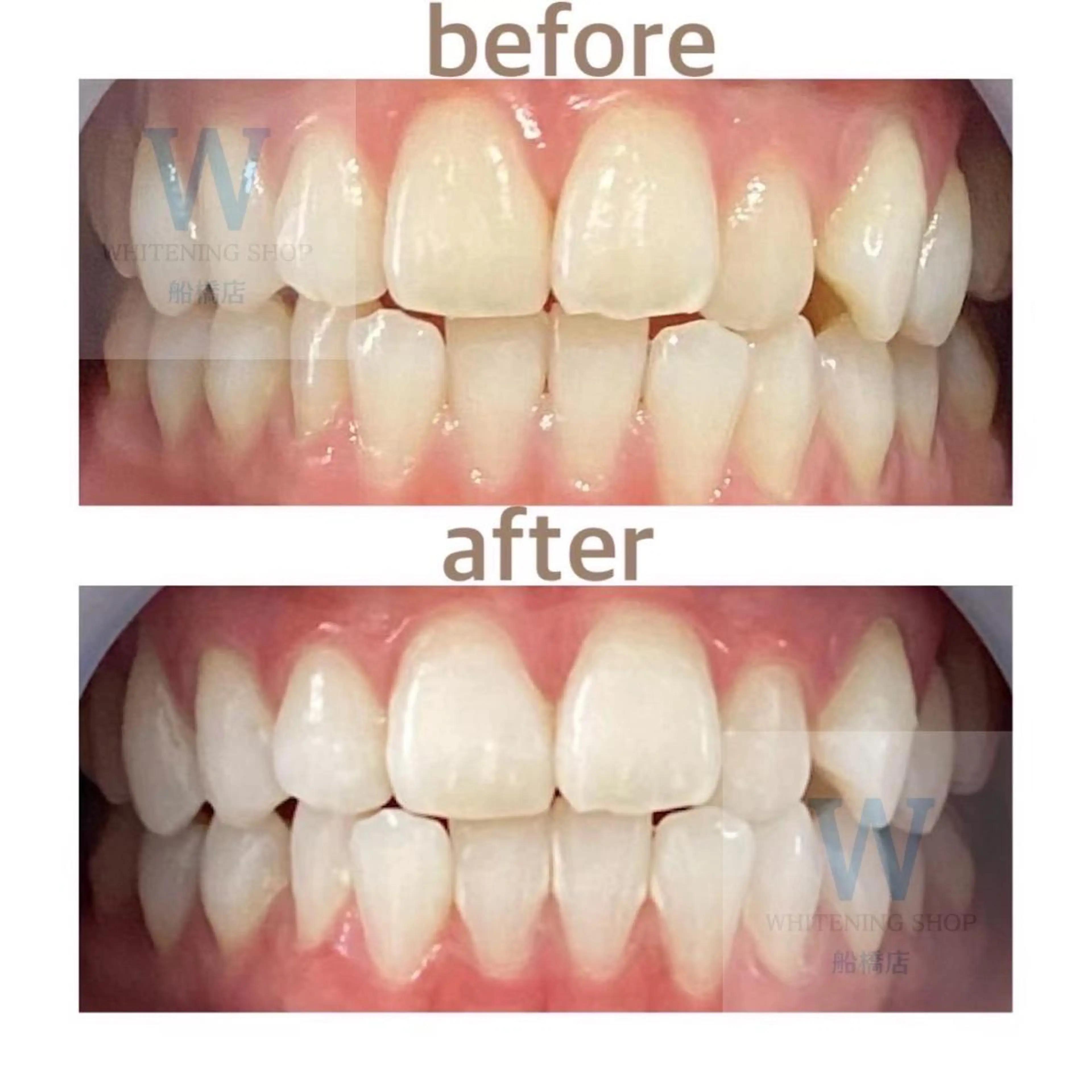 エステ リラク ホワイトニング ショップ船橋店🦷のエステ・リラクイメージ