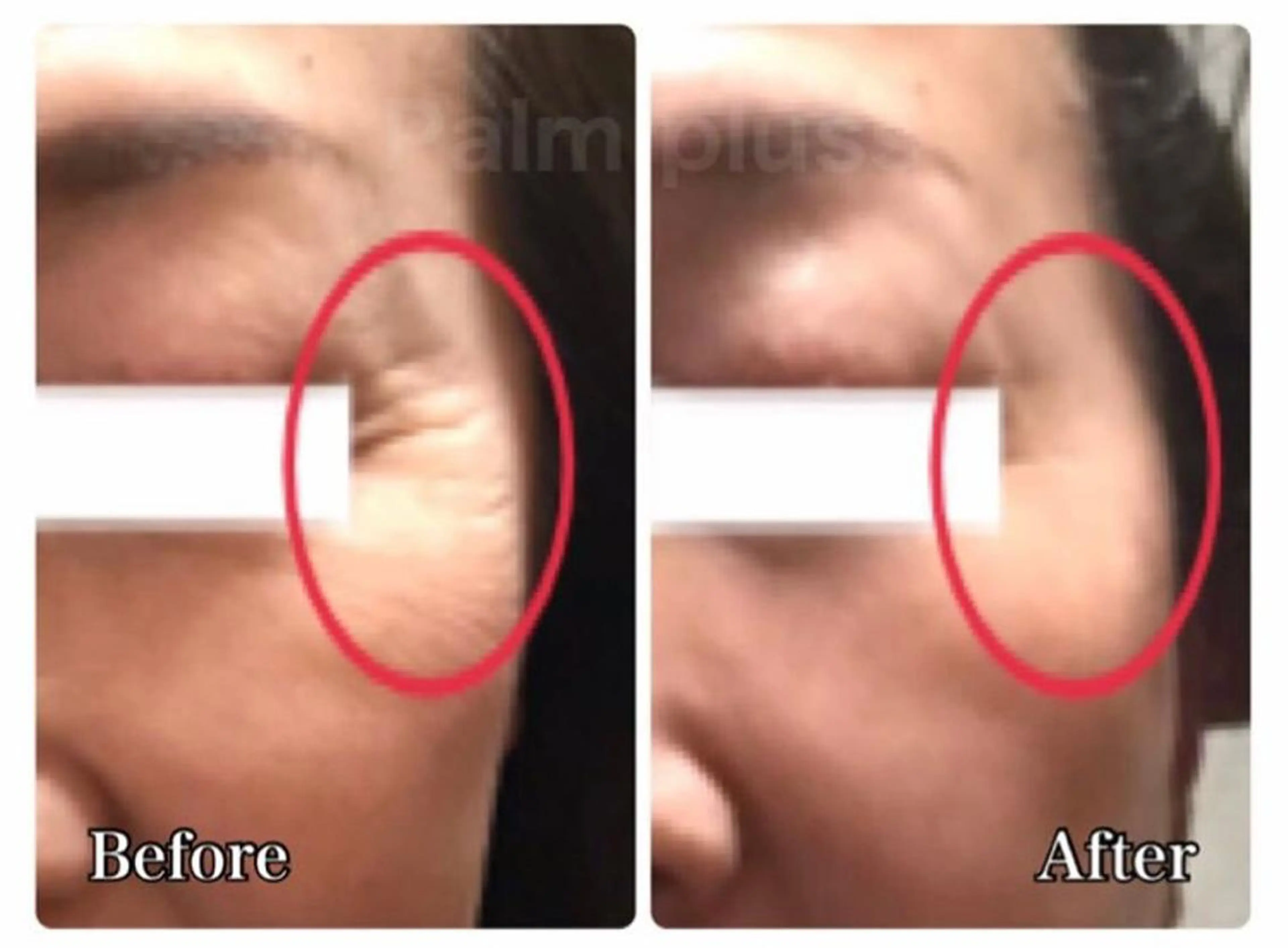 首肩こり専門サロン Kalnicco/カルニッコ所属・首肩こり専門サロン Kalniccoのエステ・リラクイメージ