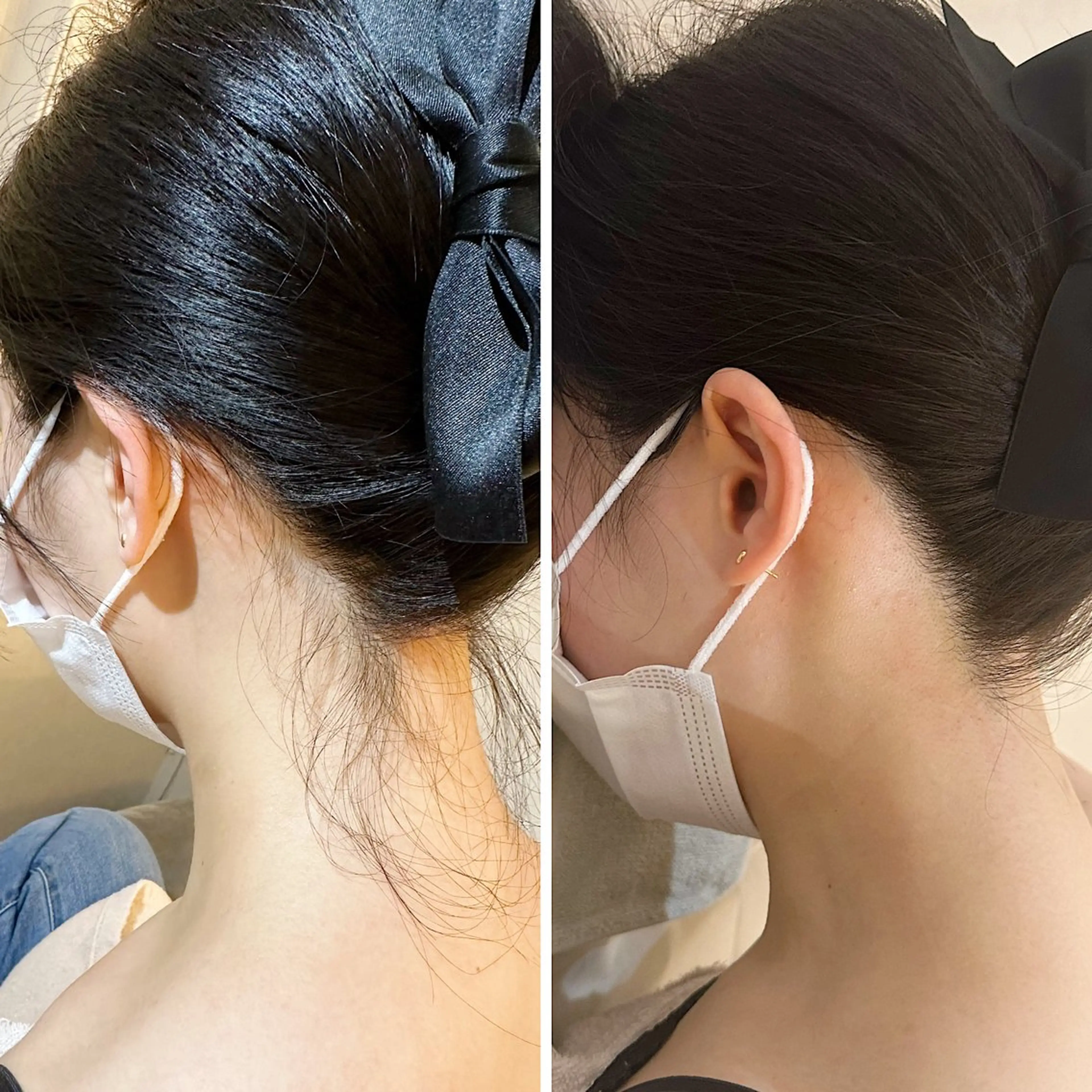 脱毛 うなじ脱毛/美肌脱毛 LABELのエステ・リラクイメージ