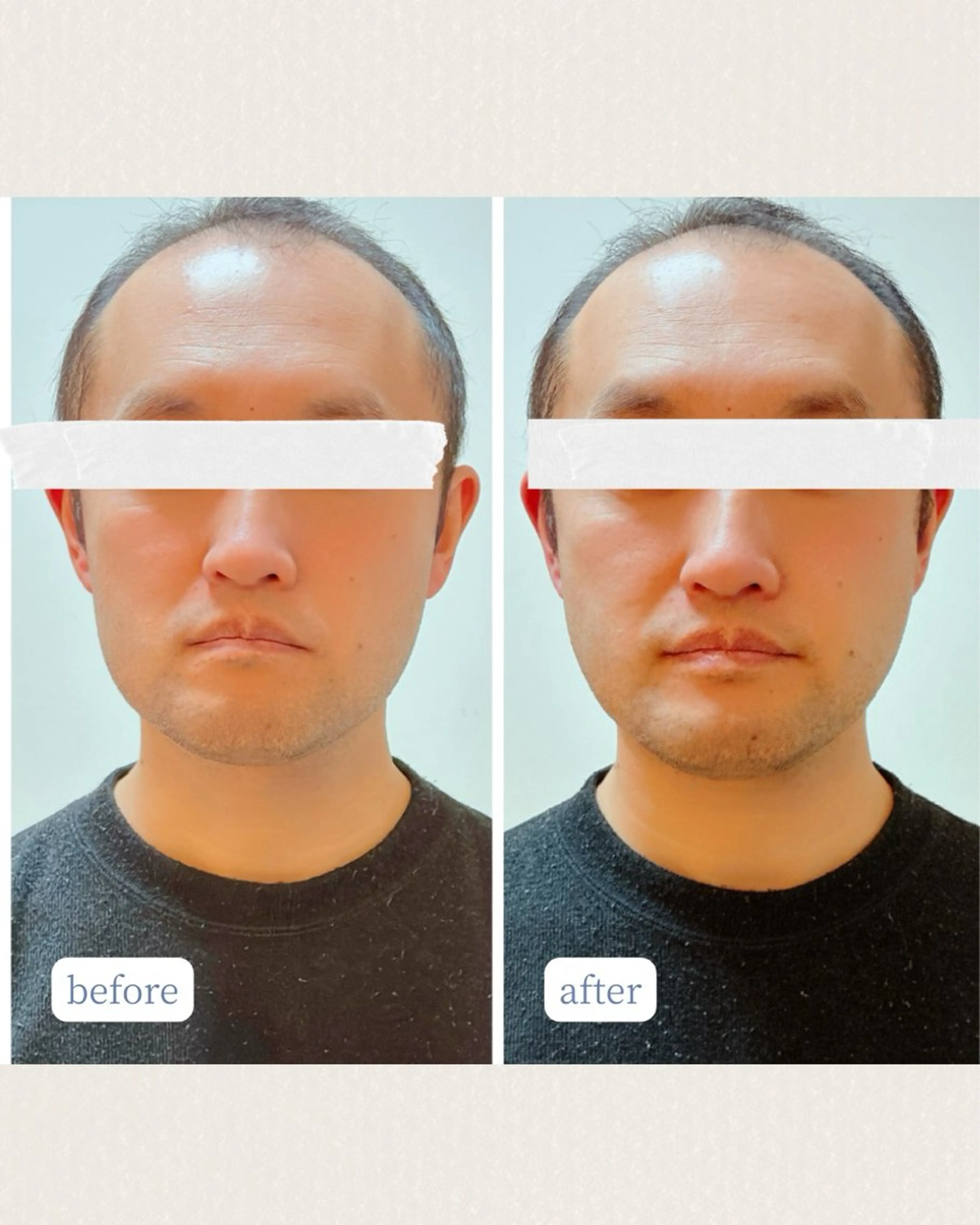 リラク 【リンパケアサロン】 well be.のエステ・リラクイメージ