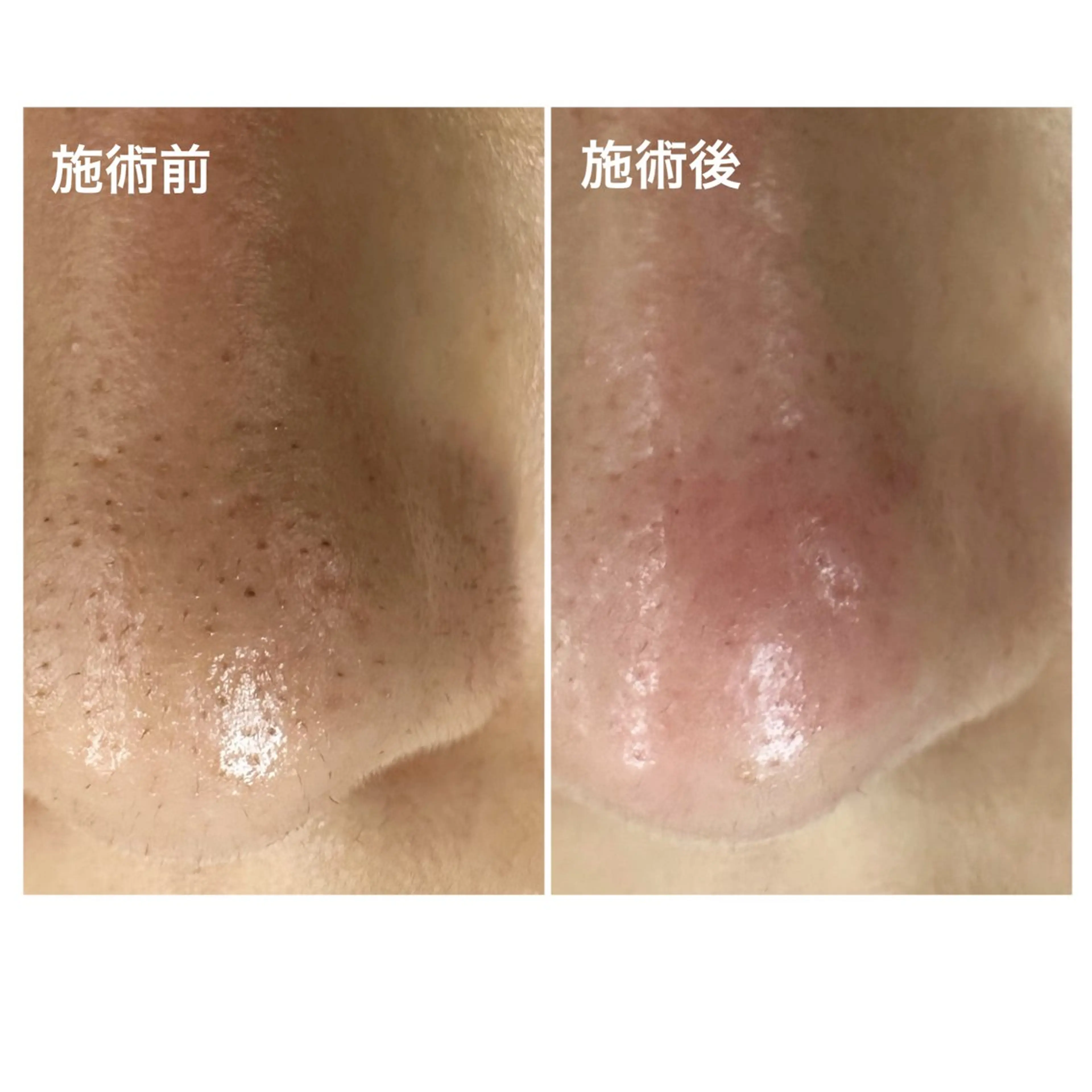 ジュルビアン美容室所属・ジュルビアン 美容室のエステ・リラクイメージ