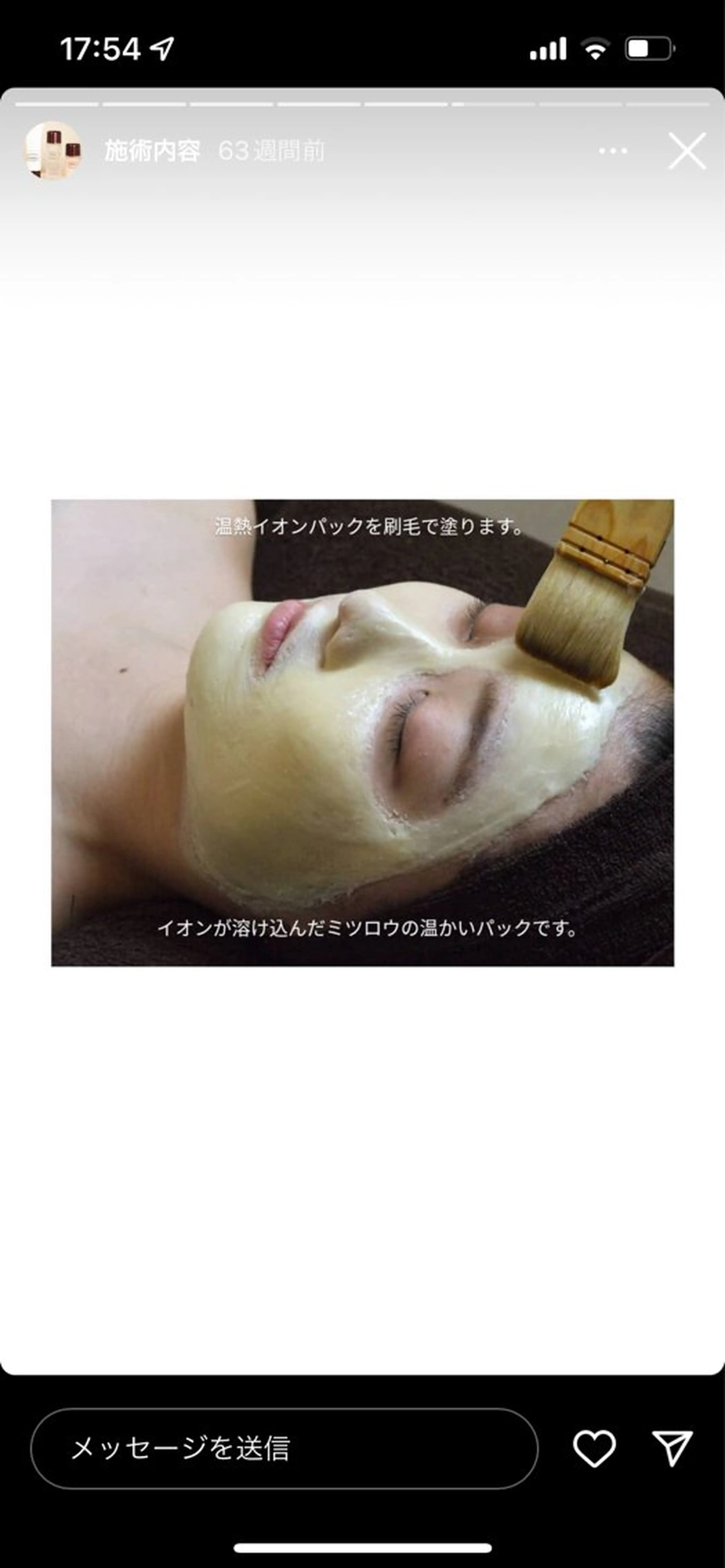 ニキビ跡改善専門🔥 医療にはできない改善のエステ・リラクイメージ