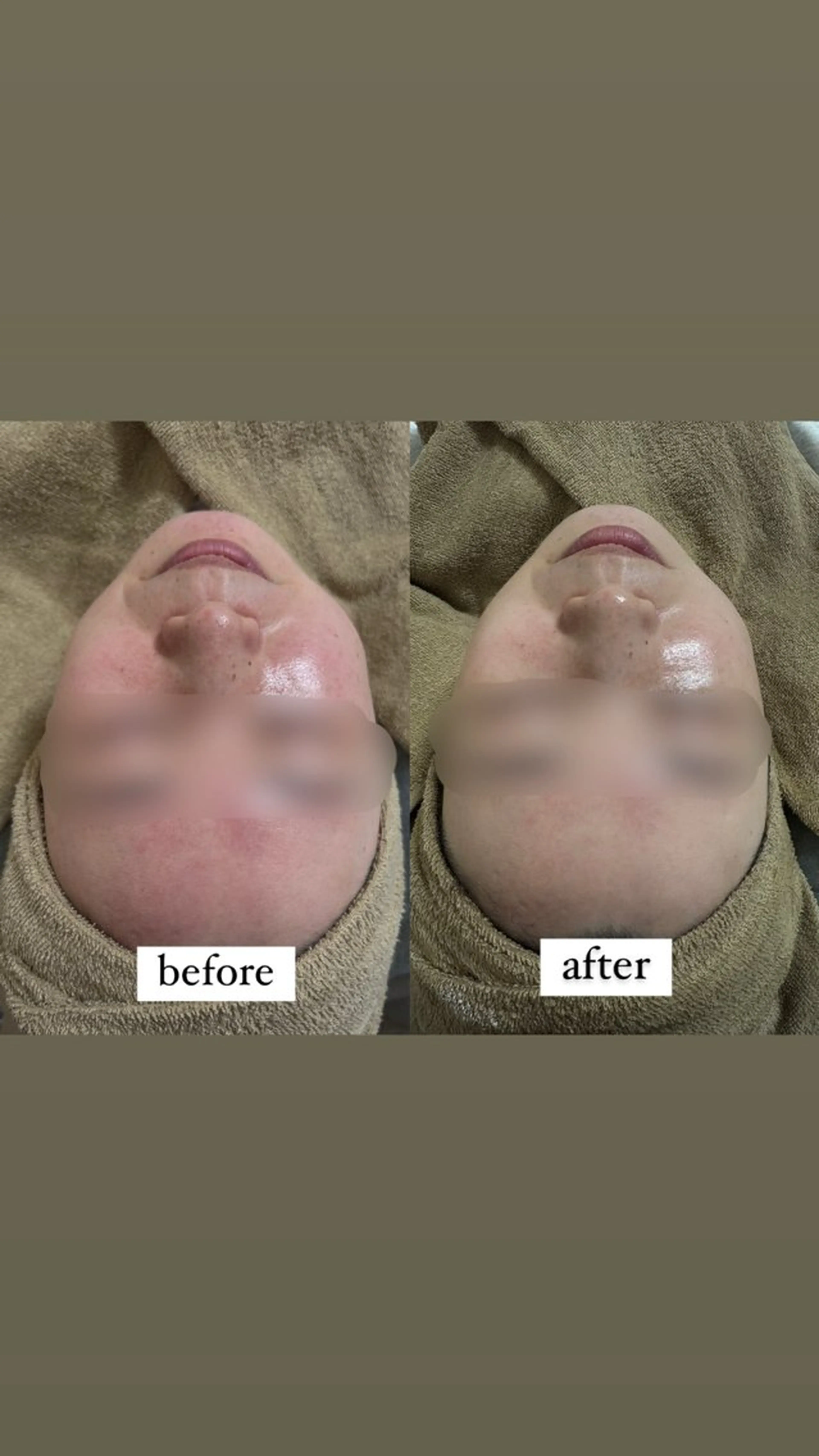 haneul ‹ハヌル›のエステ・リラクイメージ