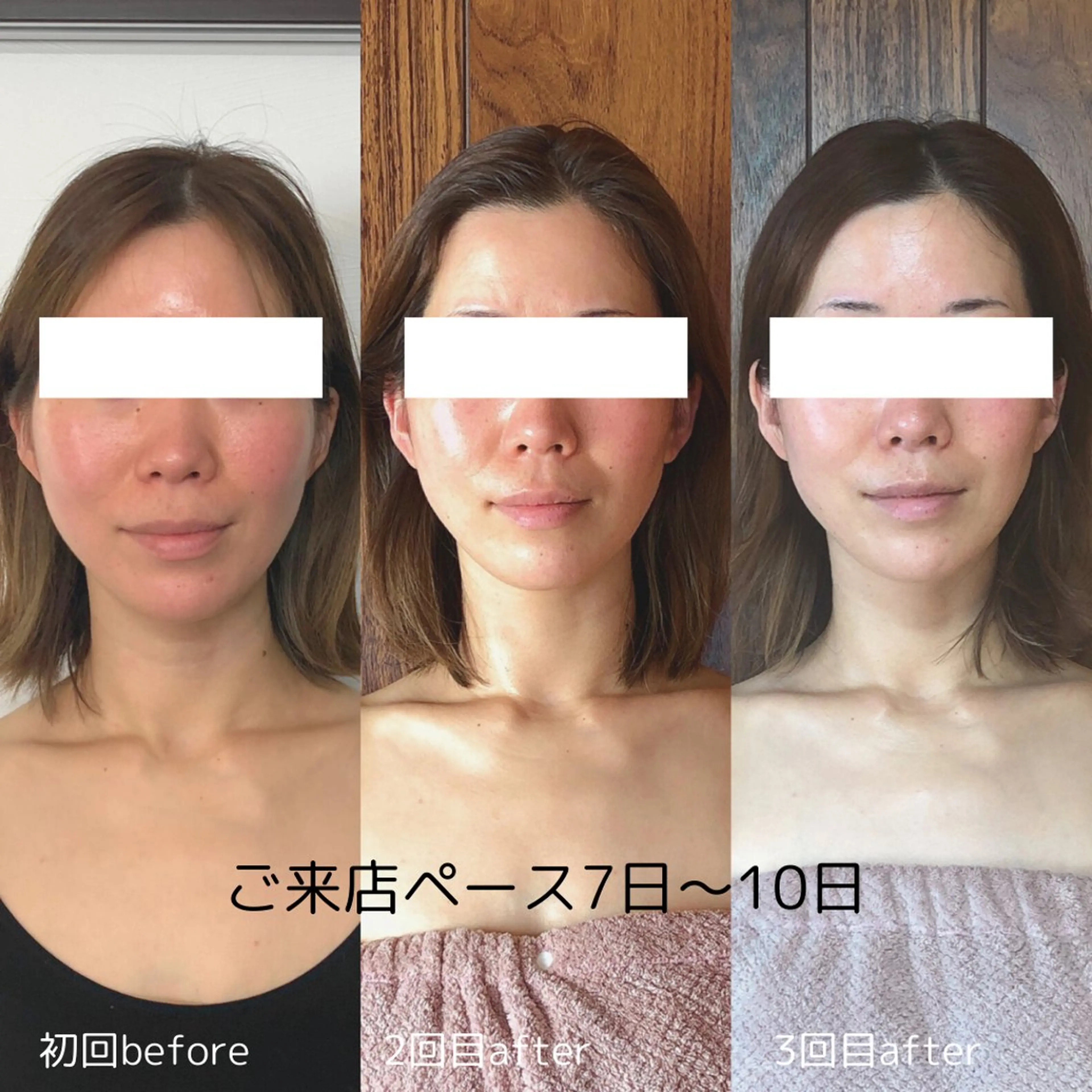 脳洗浄®︎（70分）+仰向け美背中トリートメントの写真