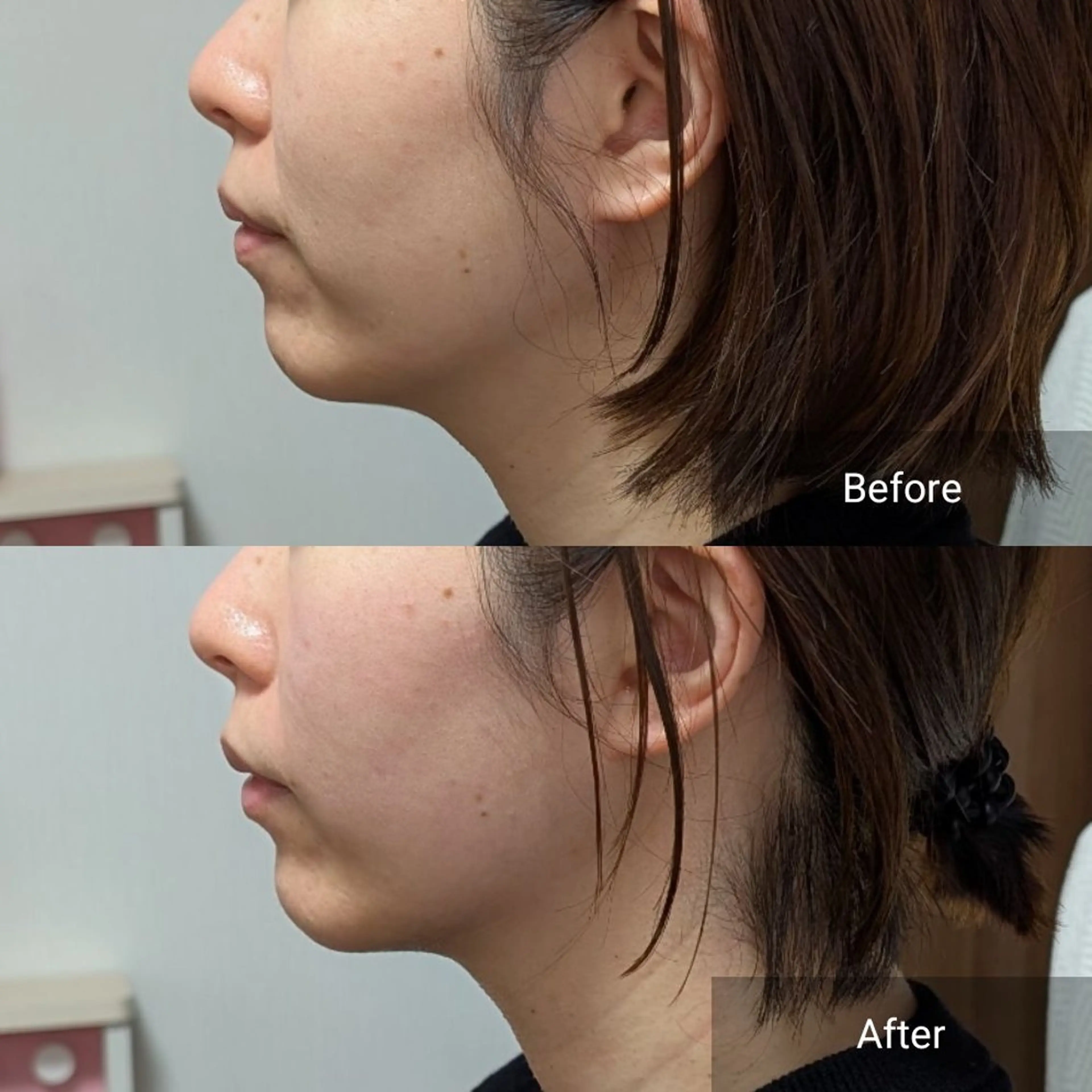 エステ nail RiRi アトレナチュラのエステ・リラクイメージ