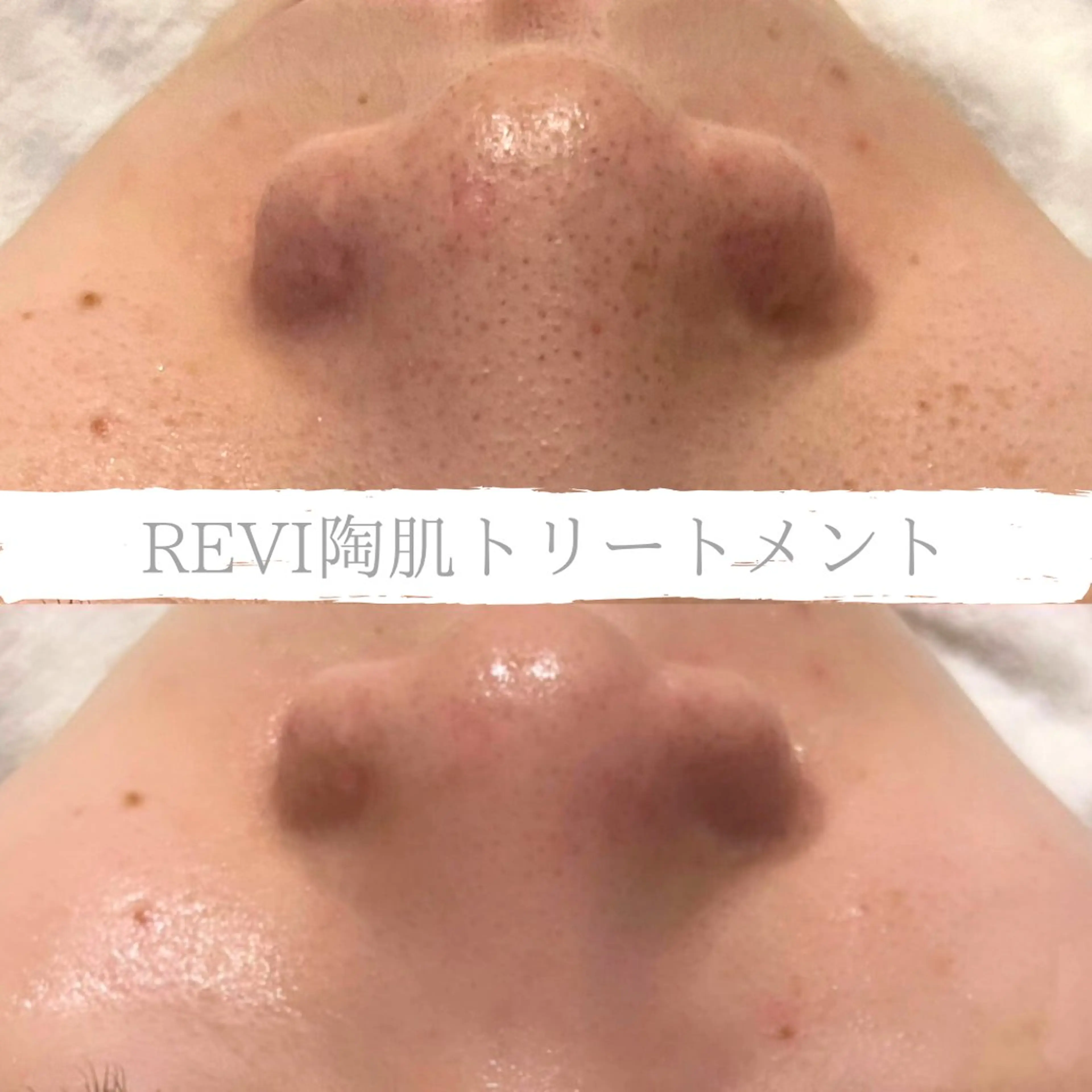 小顔&デコルテ Spa　“koti”のエステ・リラクイメージ