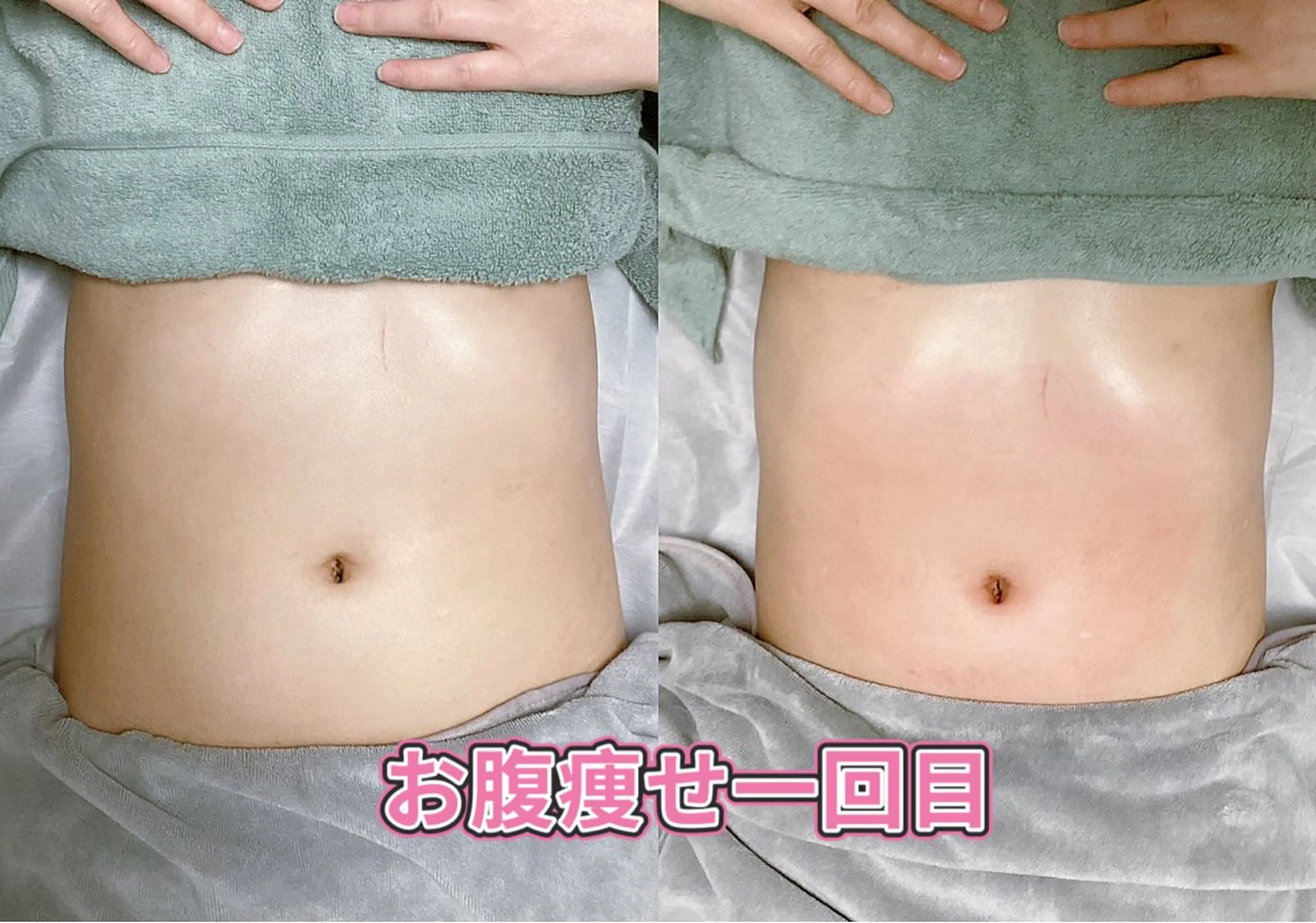 エステ リラク ホワイティアビシェル ウラワ　白澤奇のエステ・リラクイメージ