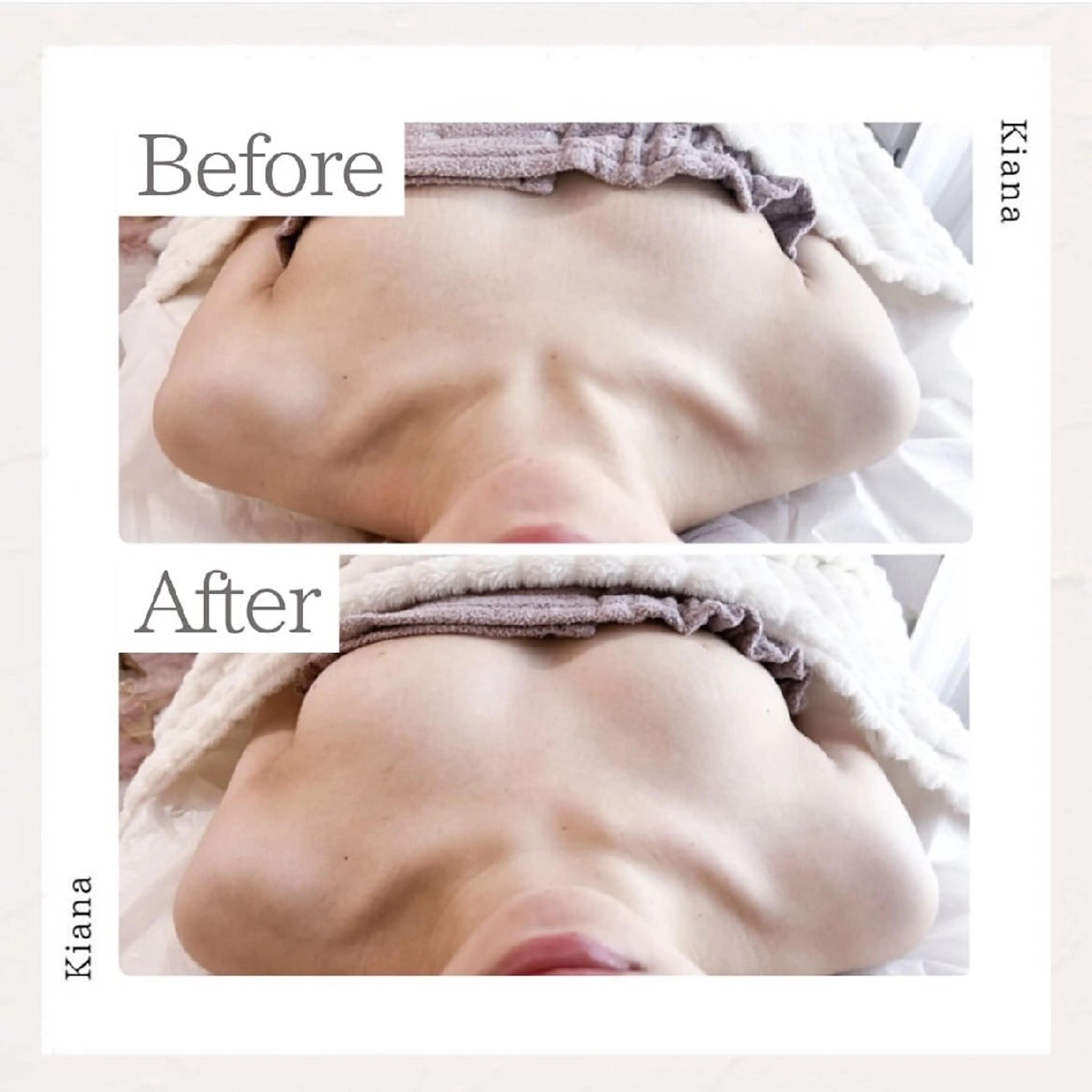 エステ リラク 【バスト専門店 】 Kiana のエステ・リラクイメージ