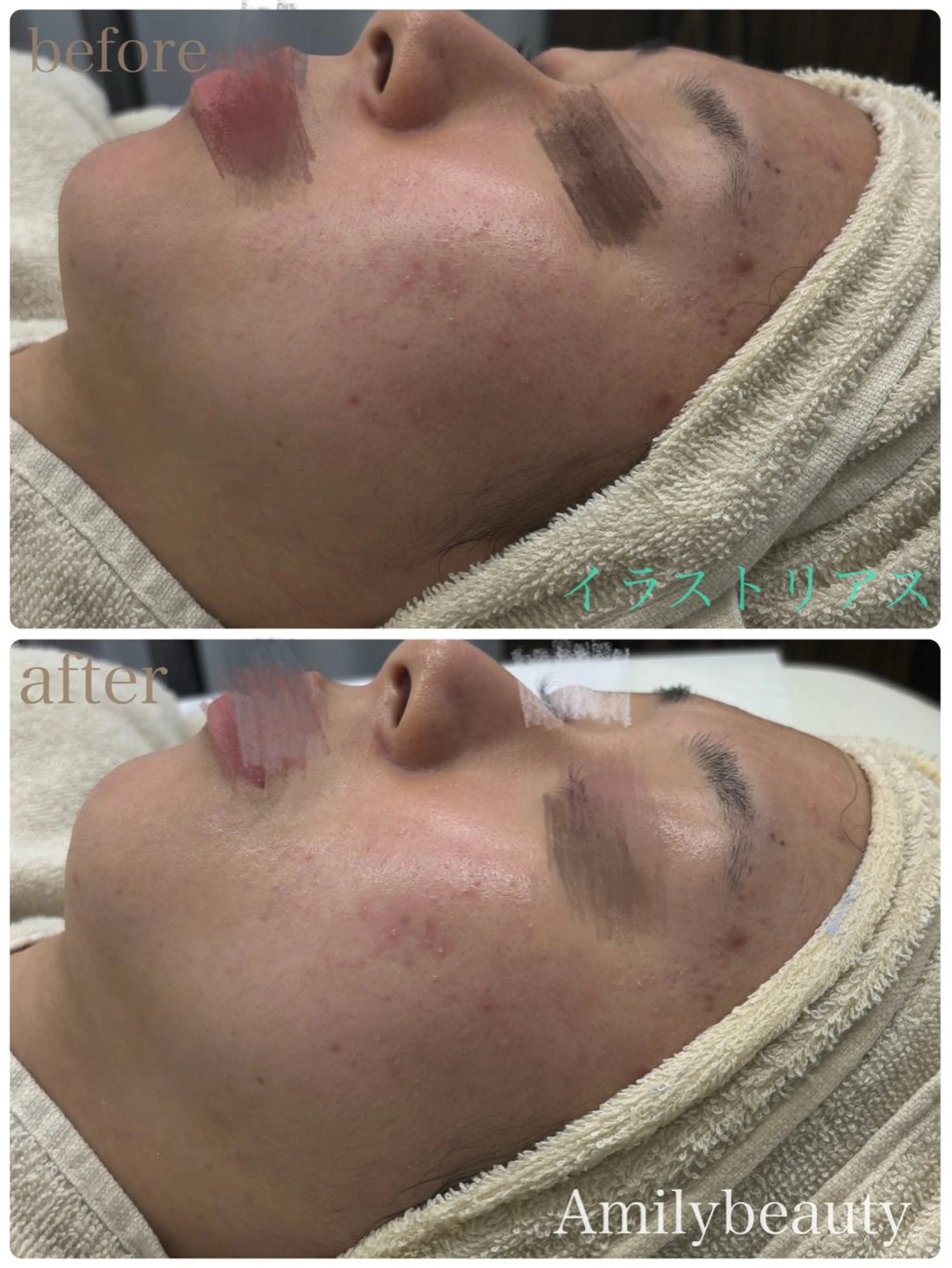 エステ Amilybeauty所属・Amily beauty 毛利のその他イメージ