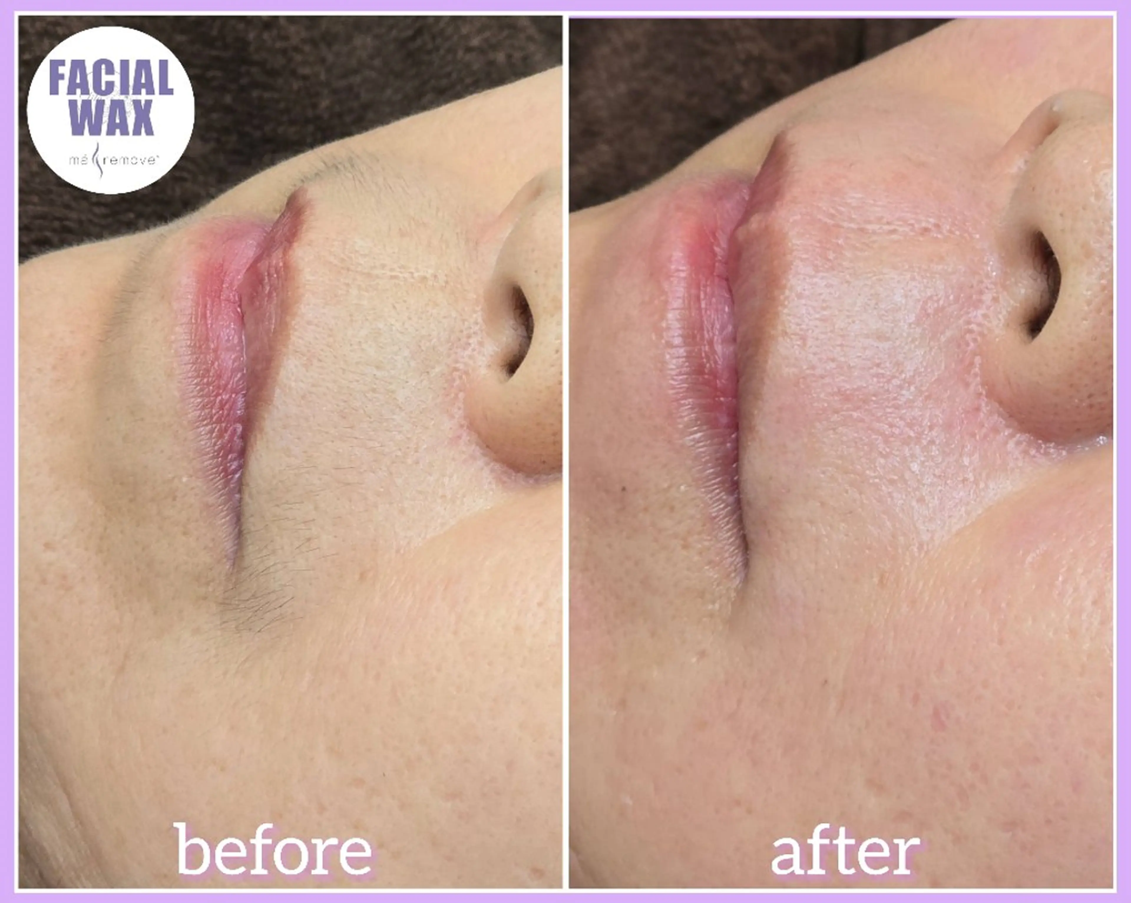 脱毛 facial salon Lily所属・salon Lilyのエステ・リラクイメージ