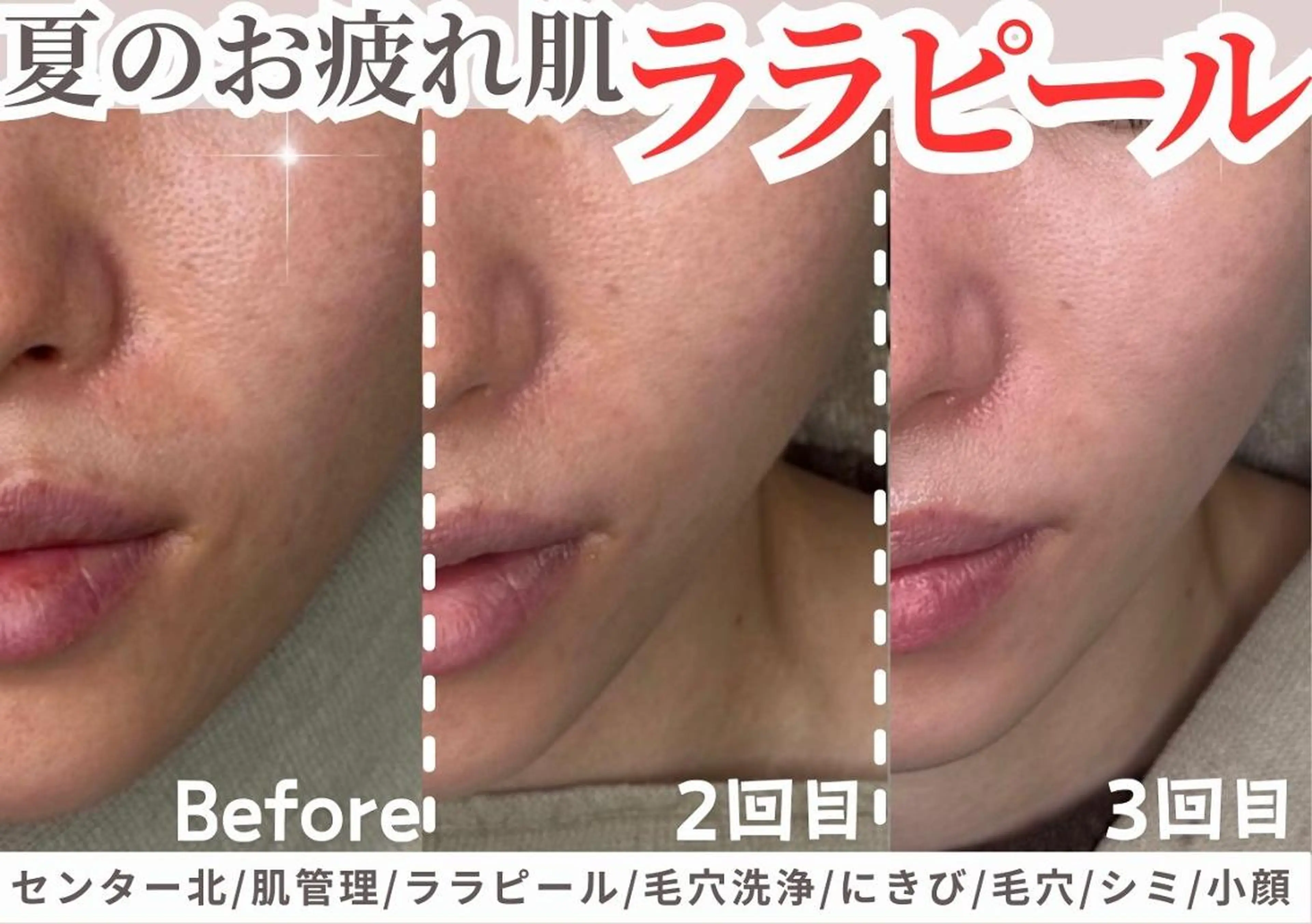 sii センター北 AIのエステ・リラクイメージ