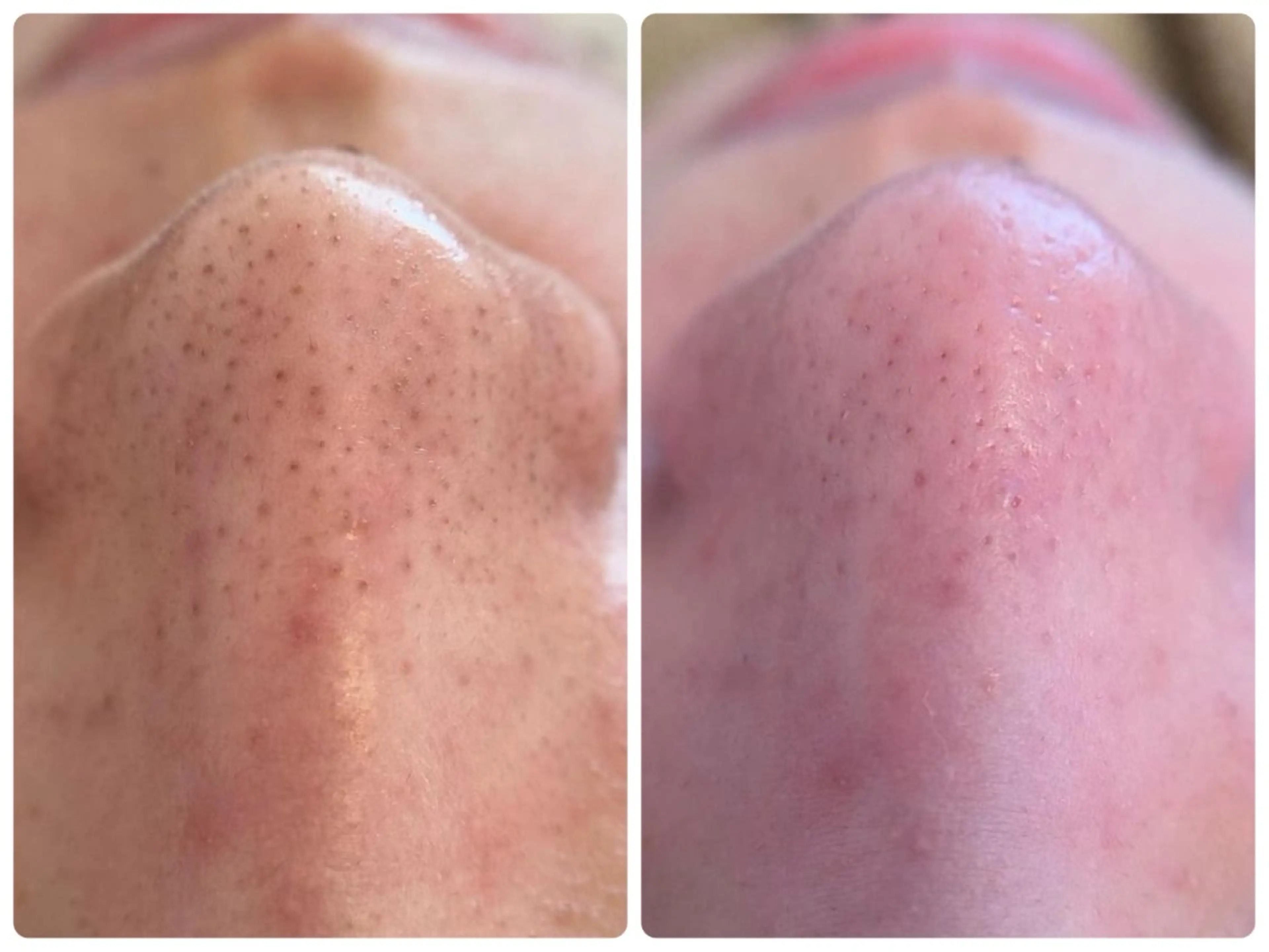 エステ Hisui 小出のエステ・リラクイメージ