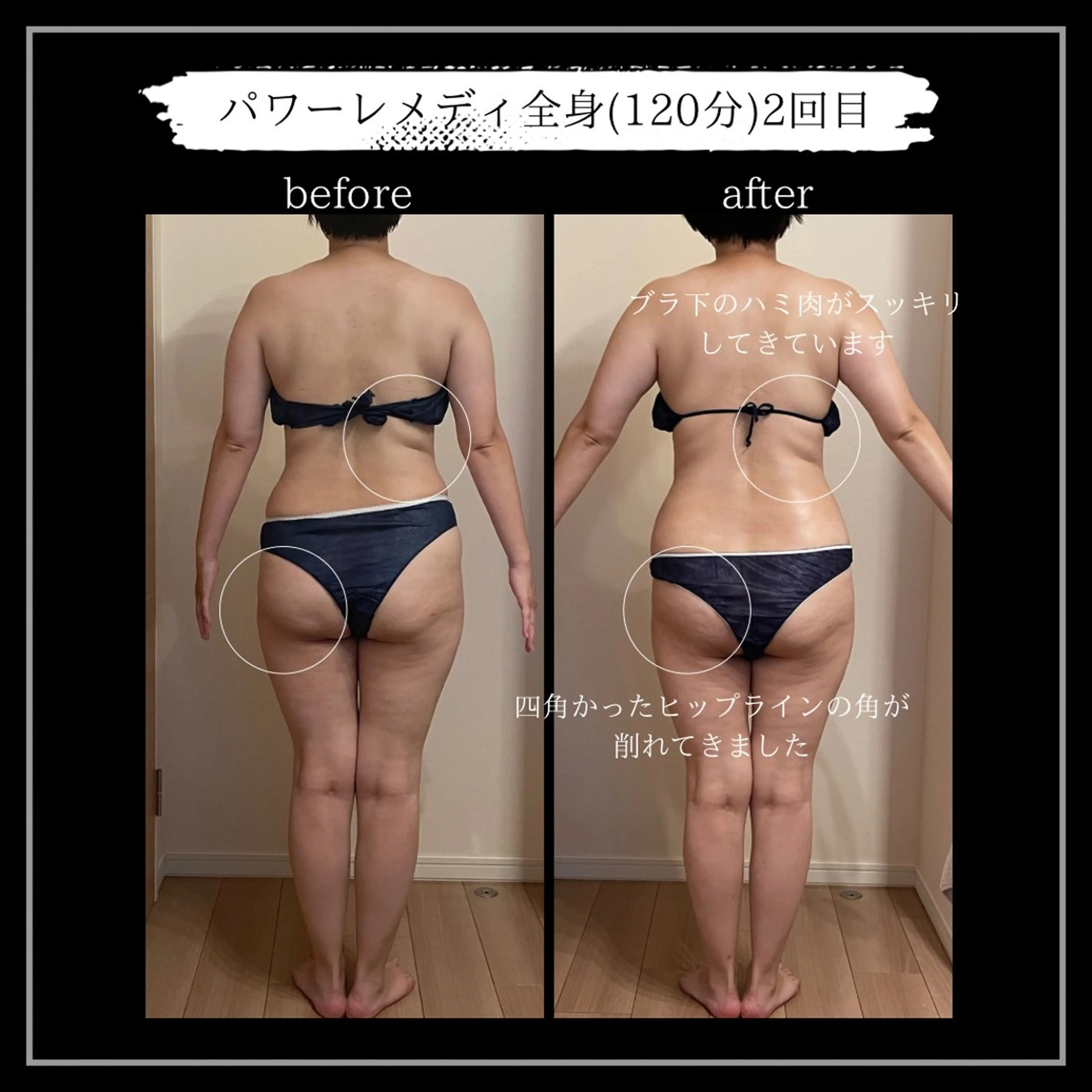 オフ:オン所属・オフ:オン 全身筋膜マッサージのエステ・リラクイメージ