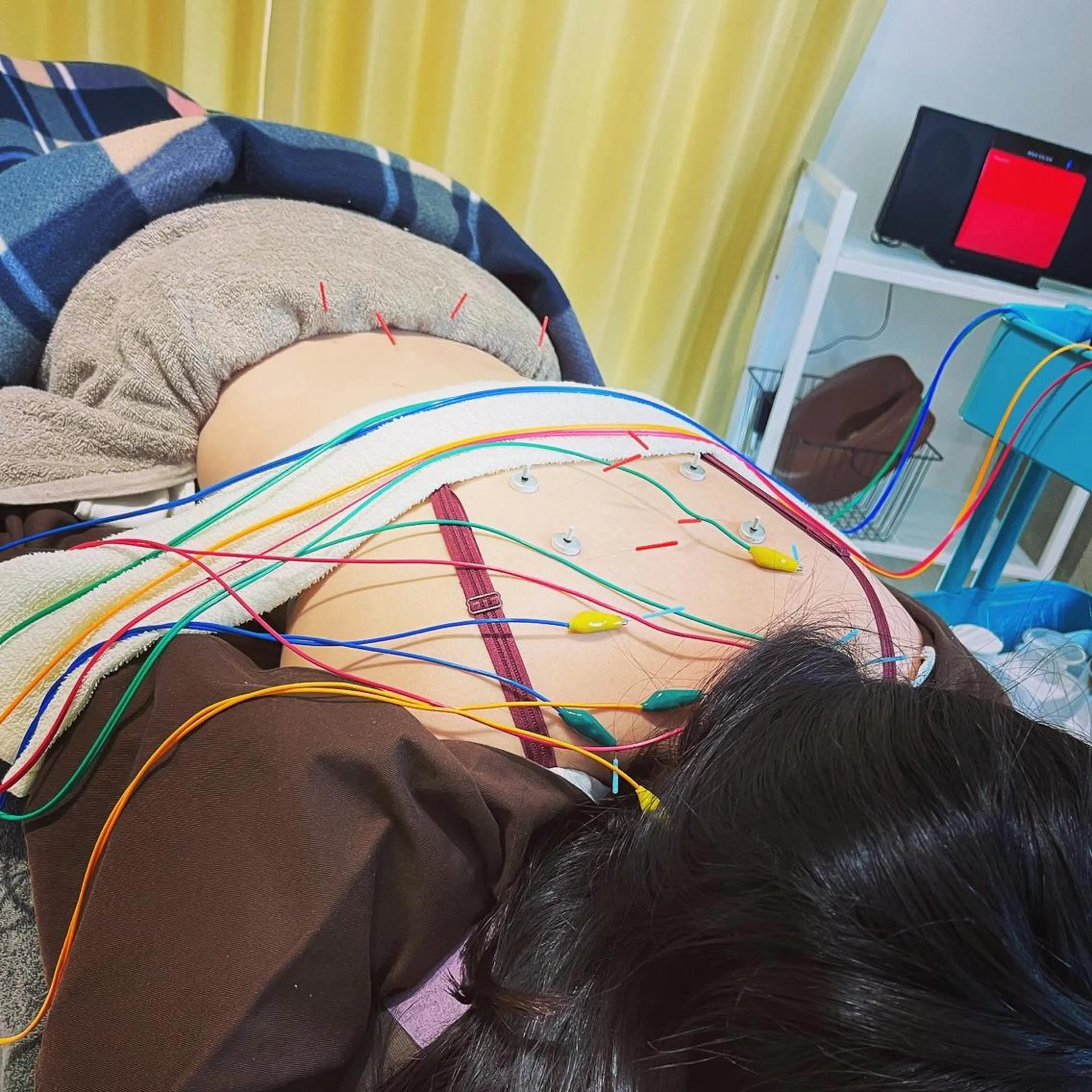 美容鍼サロン ハピネス所属・土手 真矢のその他イメージ