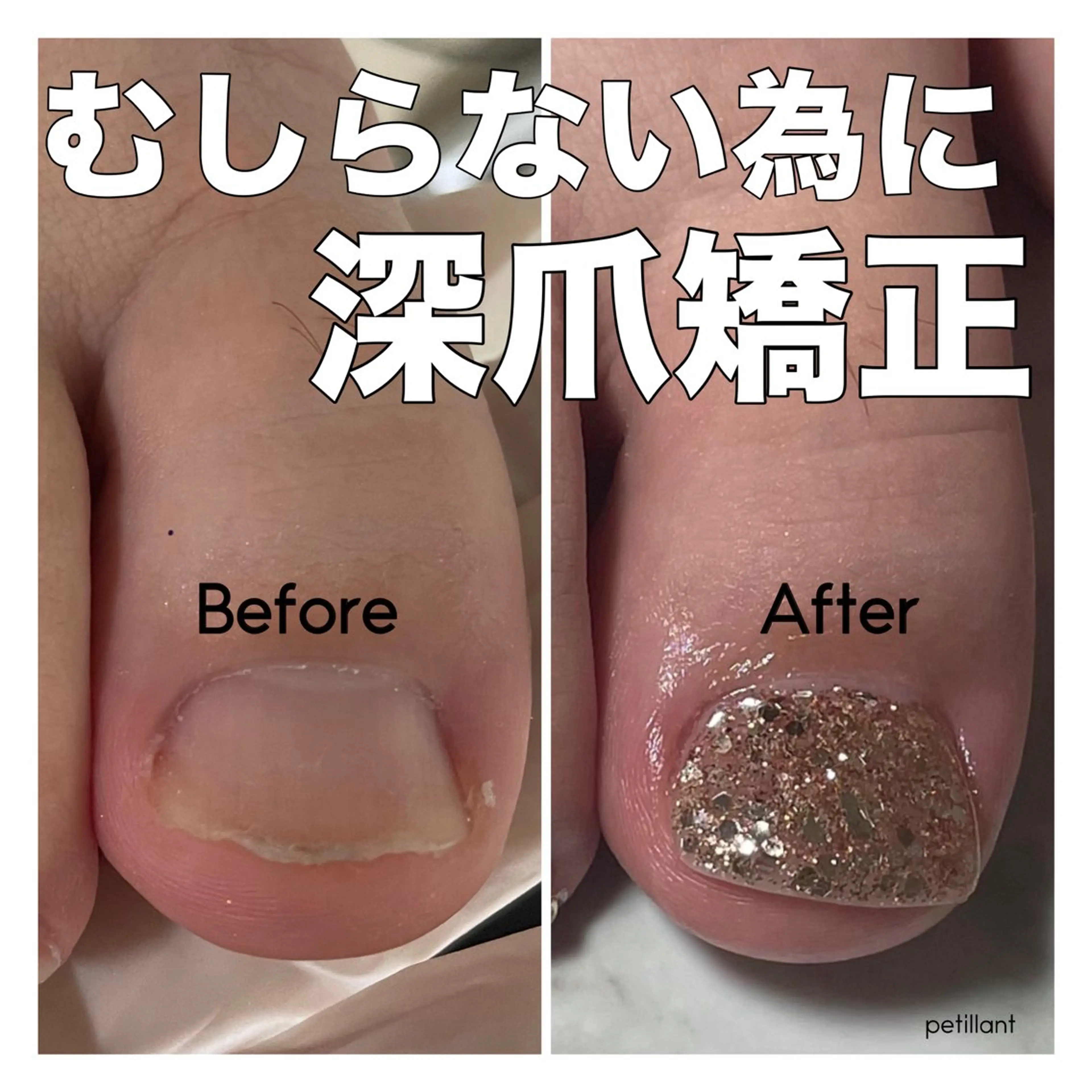 ネイル 長さ出し フットネイル petillant所属・nail salon petillantのネイルデザイン