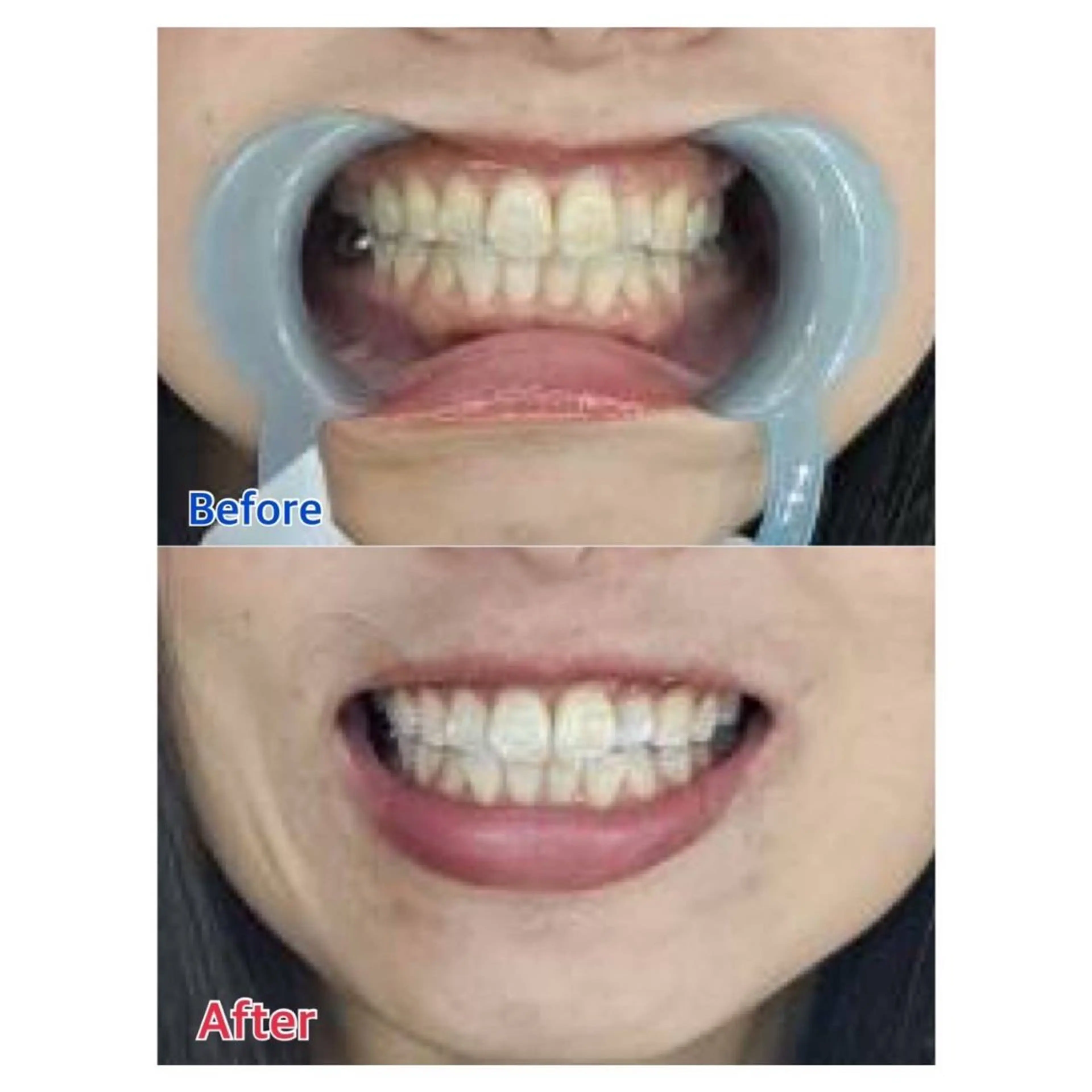 MBEAUTYSALON 千葉店・京成大久保所属・Melty 輝のその他イメージ