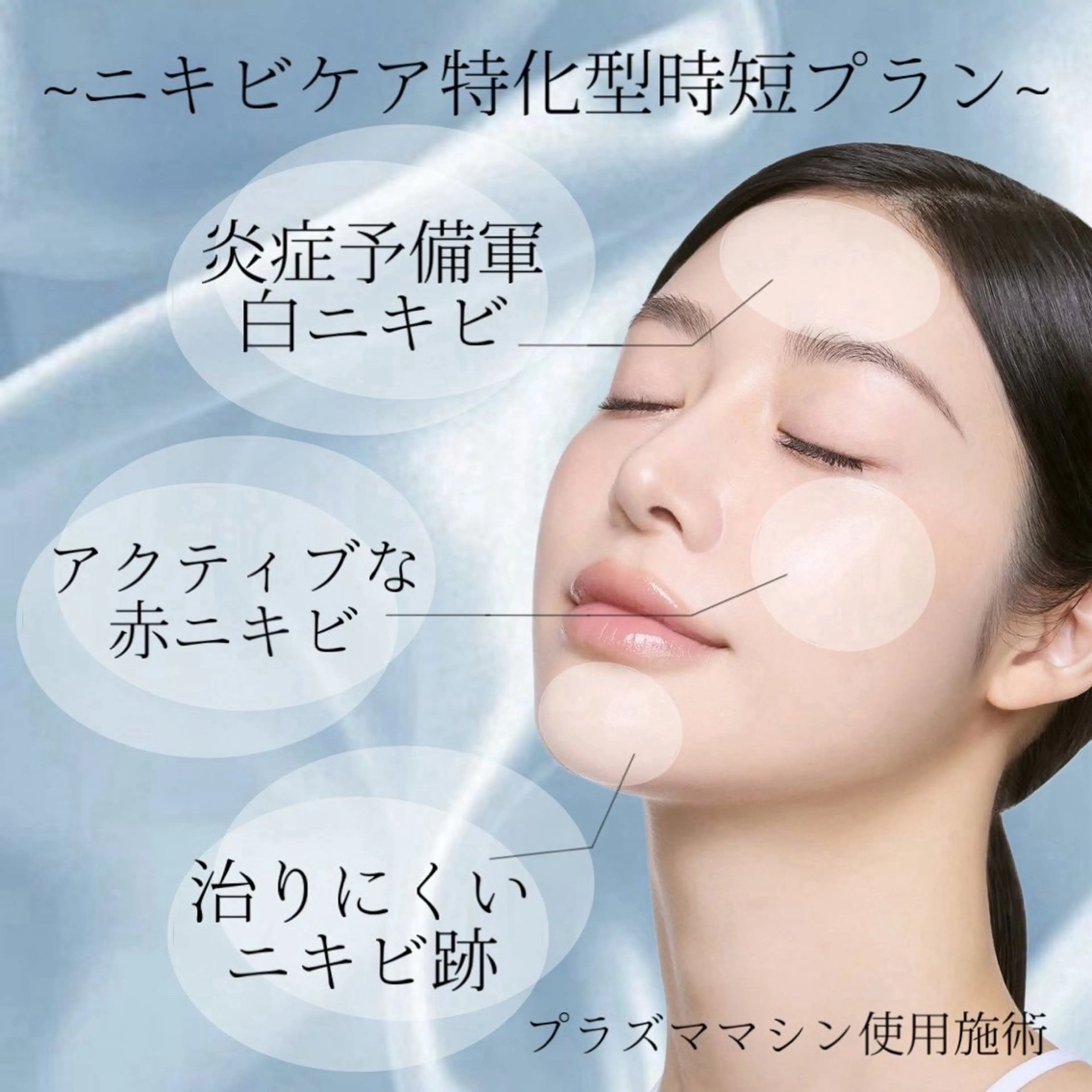 ●現在進行形・集中ニキビケア●早く元のお肌を取り戻したい方はこちら！の写真