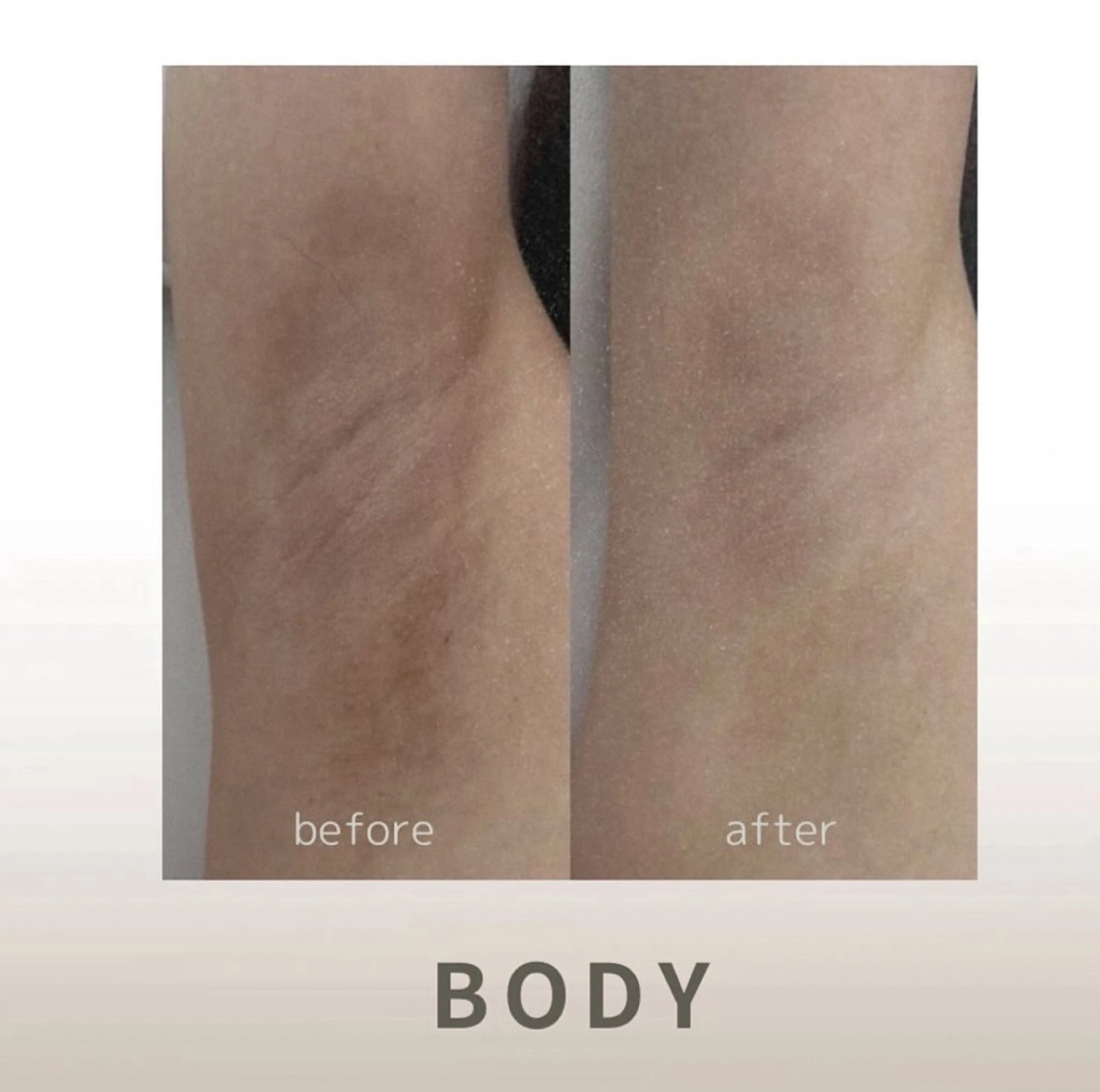 小顔/たるみ/黒ずみ除去専門サロン/SONA 大和西大寺店所属・【小顔専門看護師 サロンSONA】のエステ・リラクイメージ