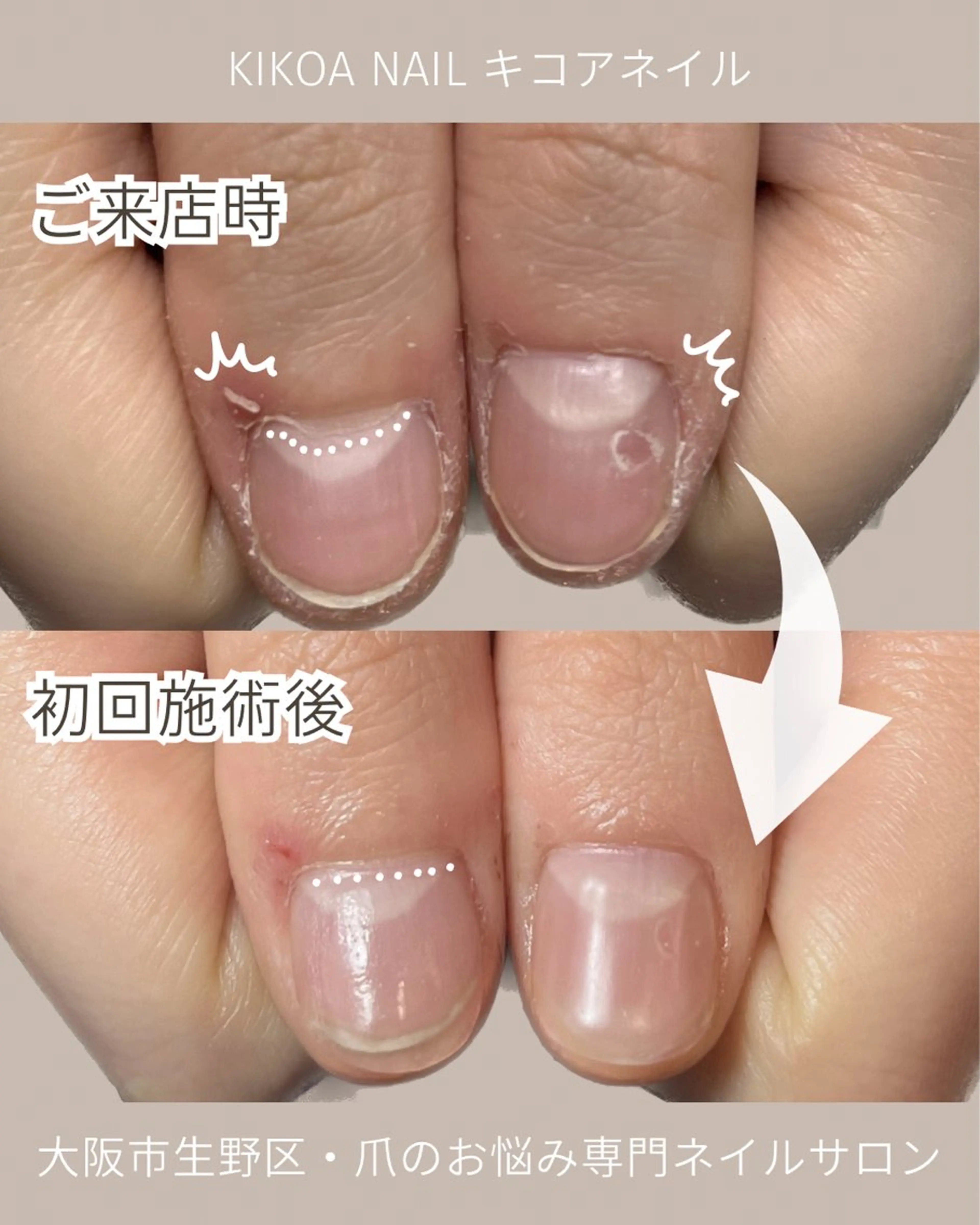 ネイル メンズネイル KIKOA NAIL キコアネイルのネイルデザイン
