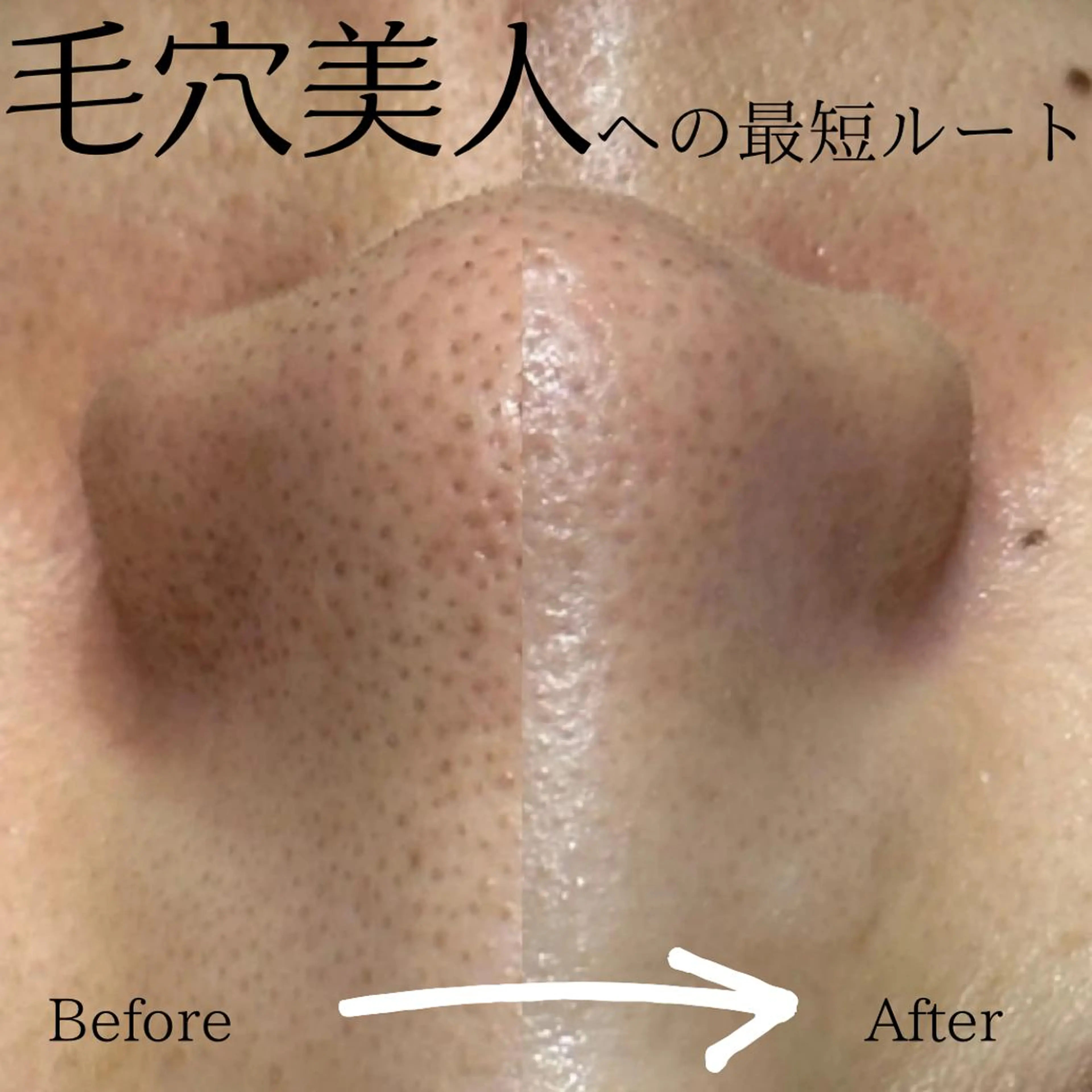 エステ リラク 🌷U24毛穴エステ レイビス川崎🌷のエステ・リラクイメージ