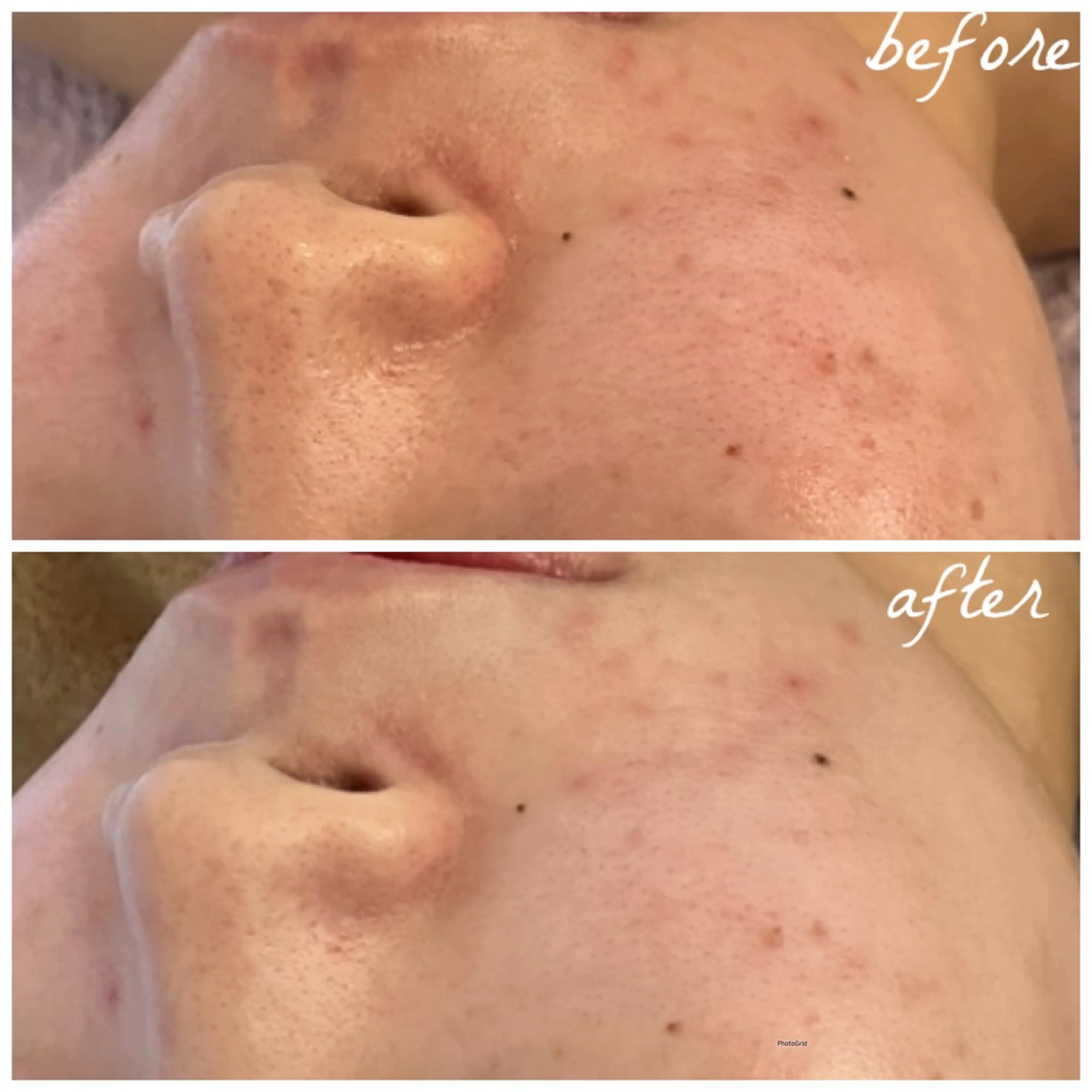 メンズ メナード岐阜茜部 杉浦のエステ・リラクイメージ