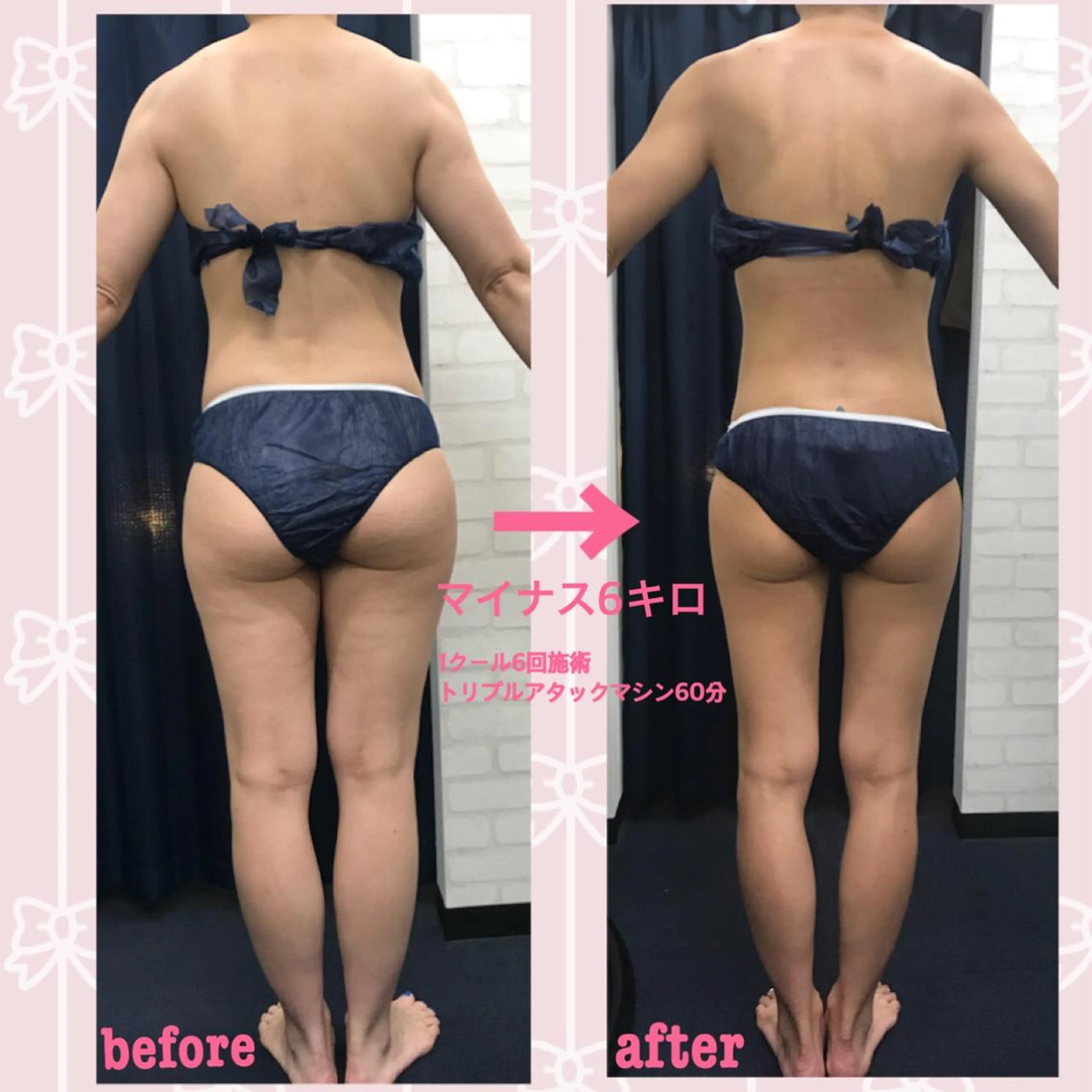 エステ リラク アイトータル ビューティーのエステ・リラクイメージ