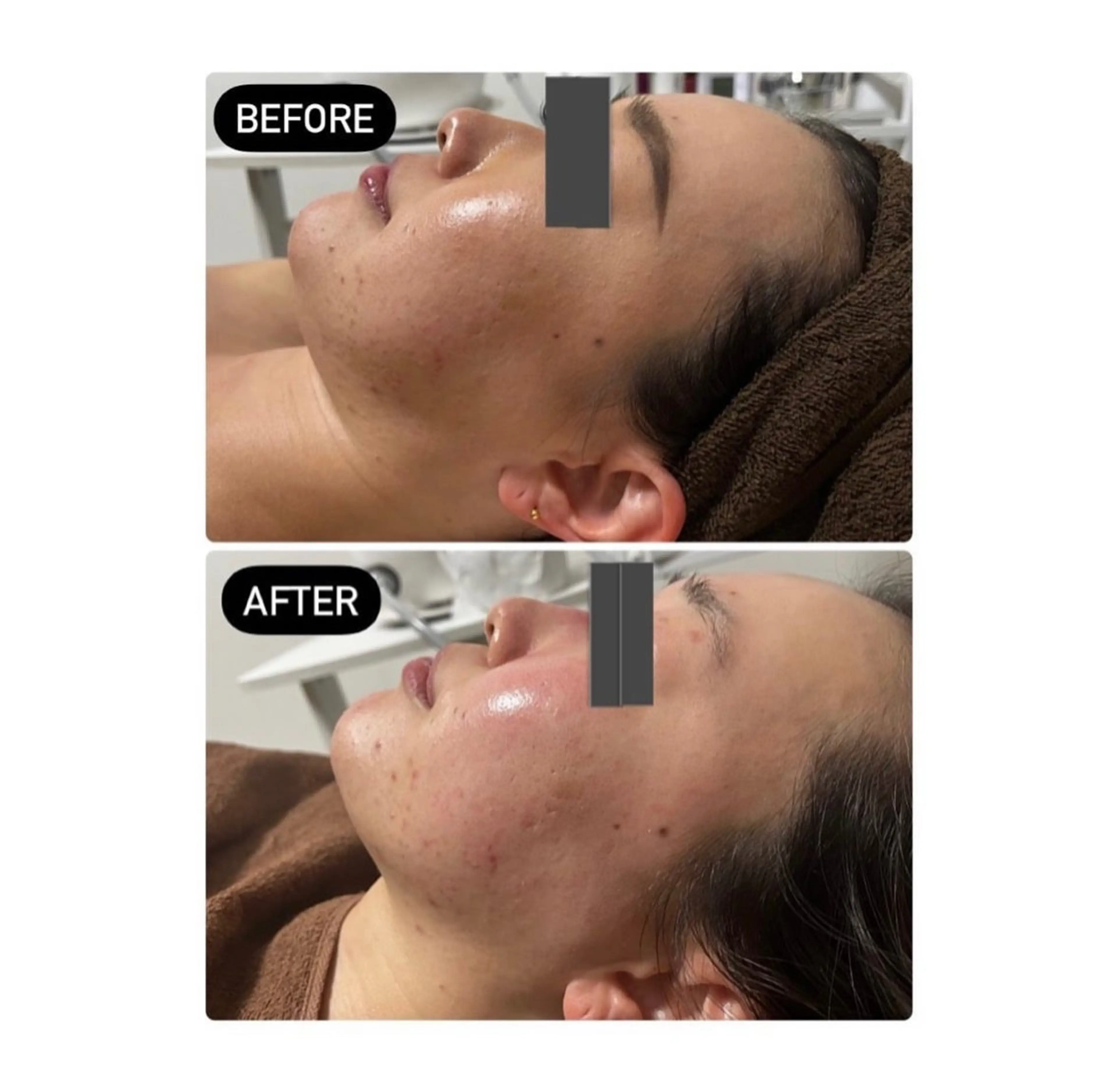 IBERIA心斎橋店 🌼凝り小顔美肌痩身のエステ・リラクイメージ