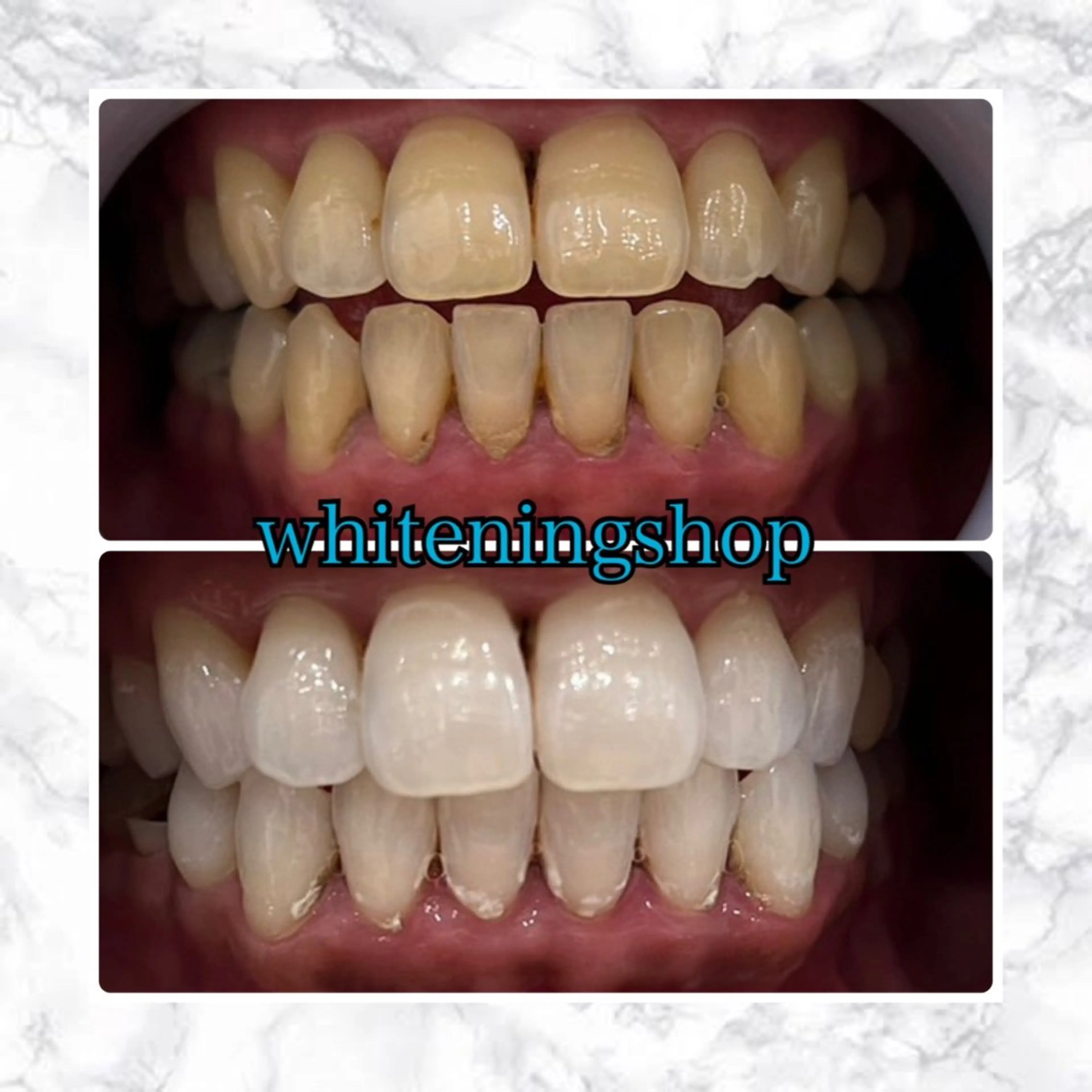 ホワイトニングショップ津店所属・ホワイトニング ショップ津店のその他イメージ