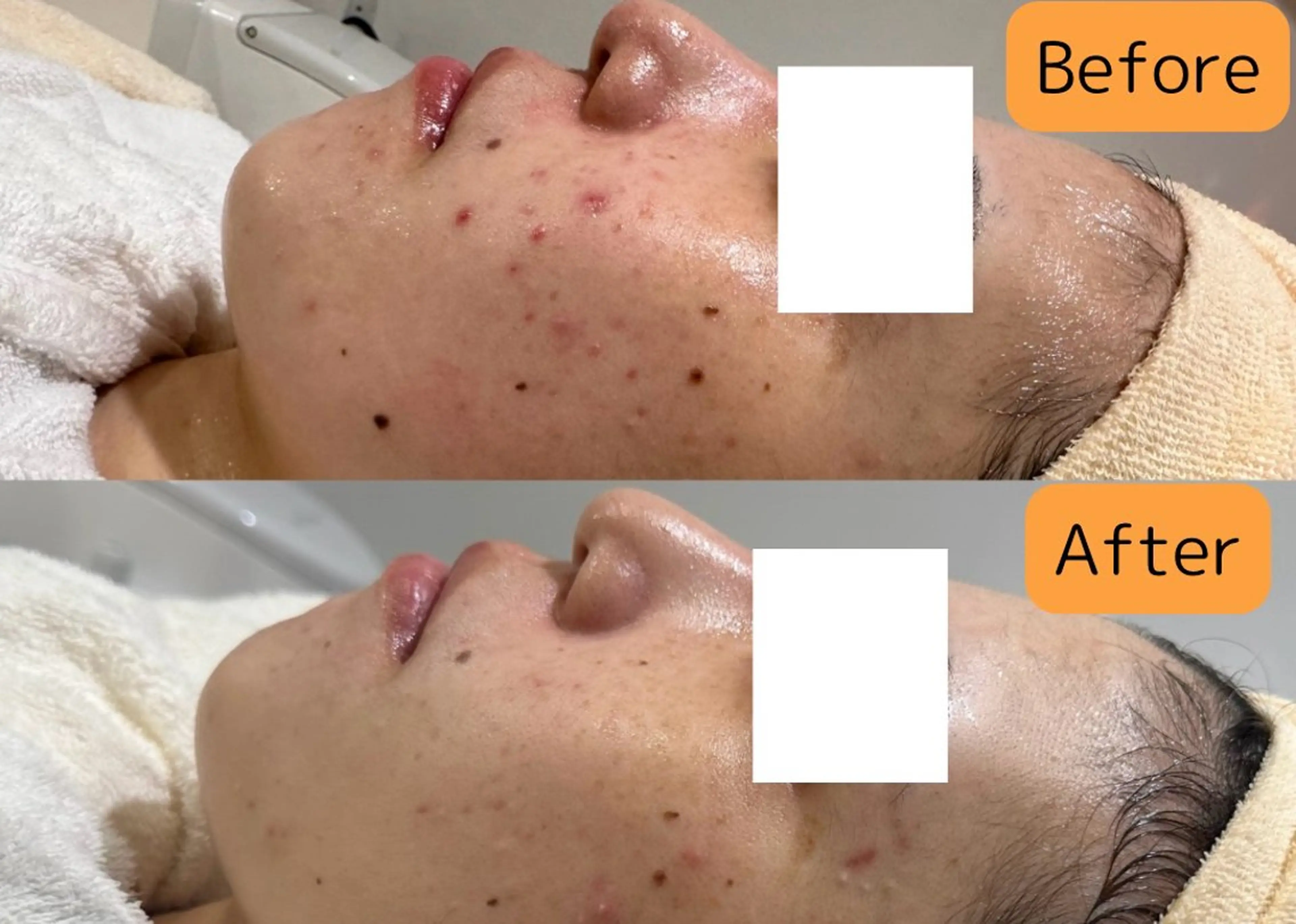 エステ pansy(パンジー)上野フェイシャルエステ専門店所属・pansy saraのエステ・リラクイメージ