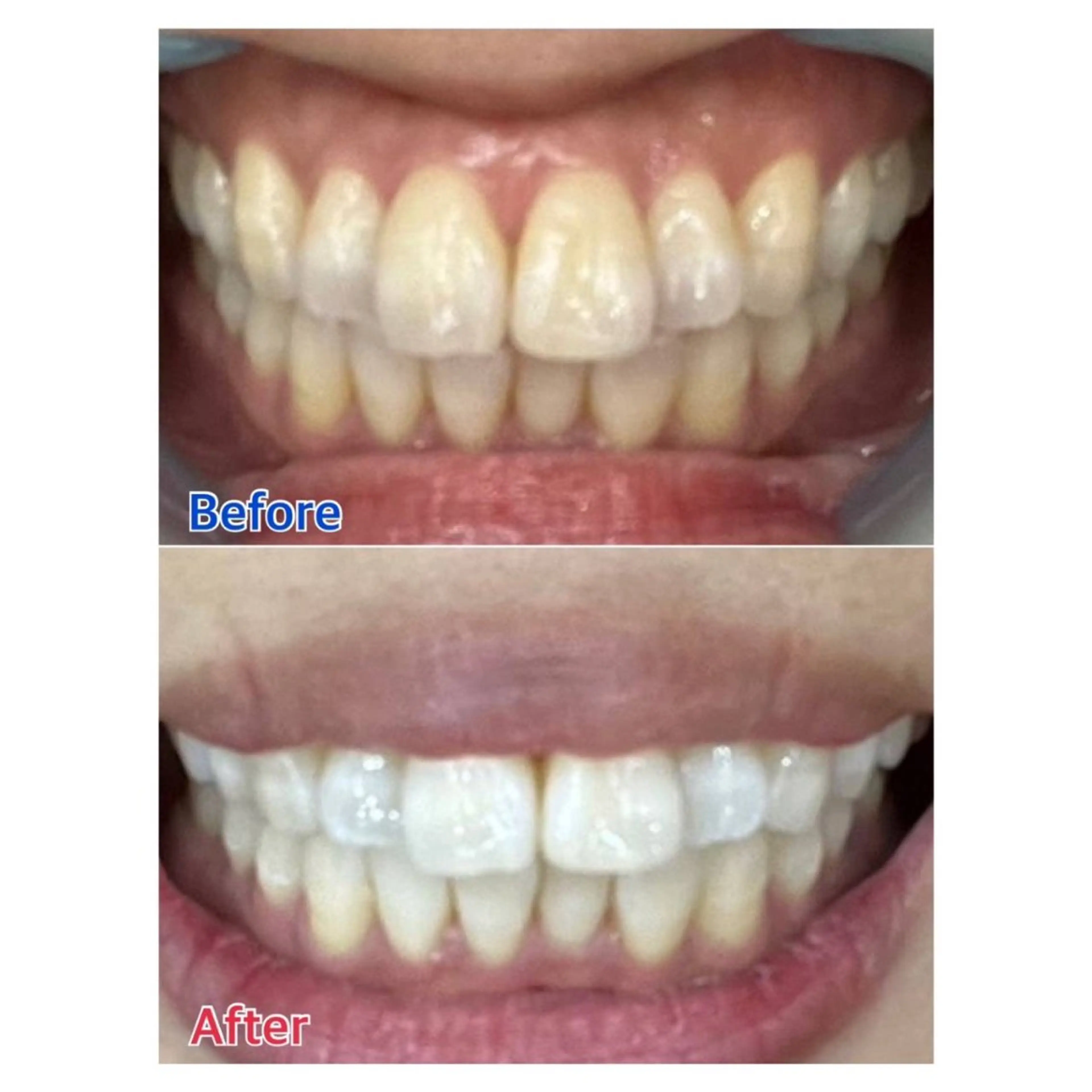 MBEAUTYSALON 千葉店・京成大久保所属・Melty 輝のその他イメージ