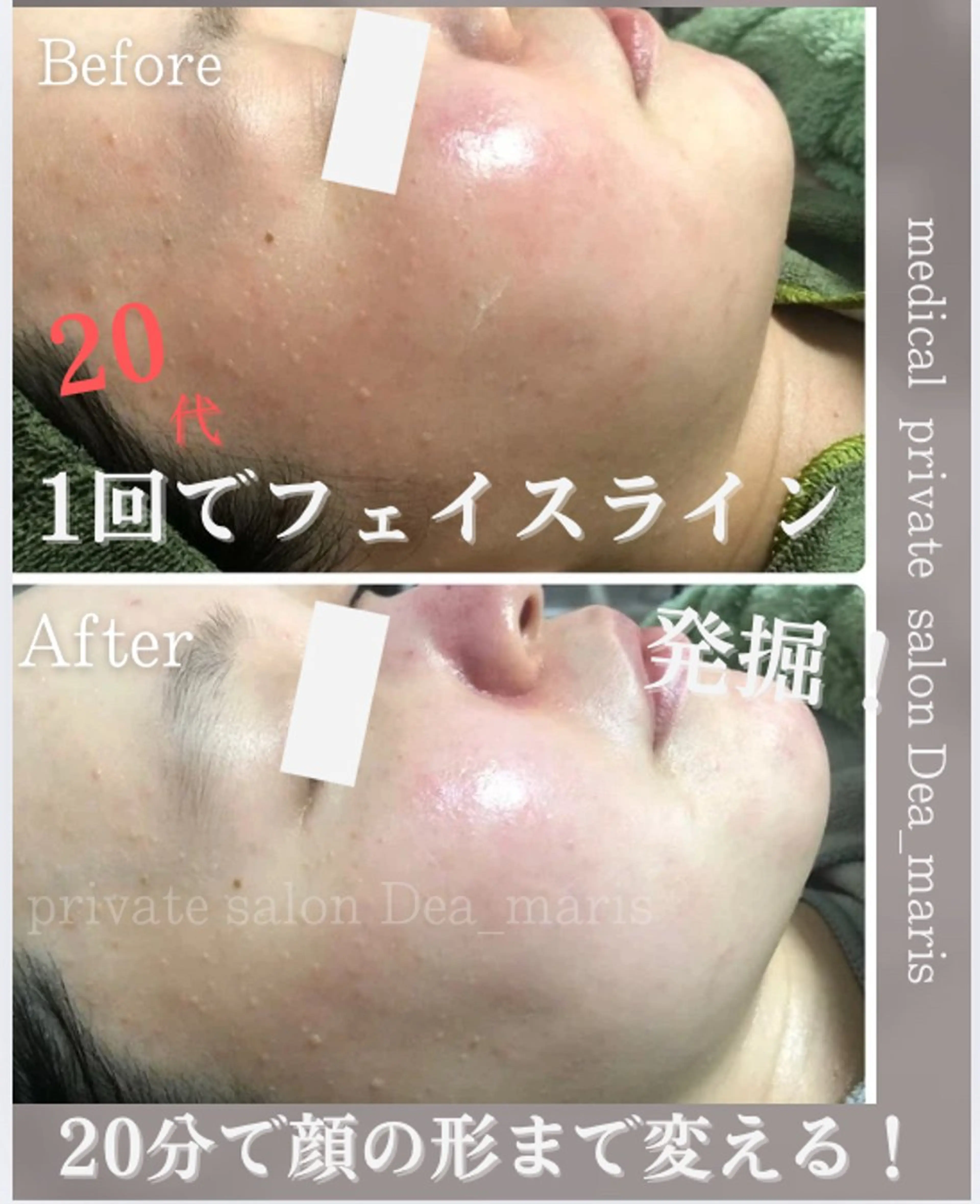 private salon  Dea_maris シュガーリング＆パーソナルボディケア所属・シミ改善・韓国肌管理 ボディメイク痩身のその他イメージ