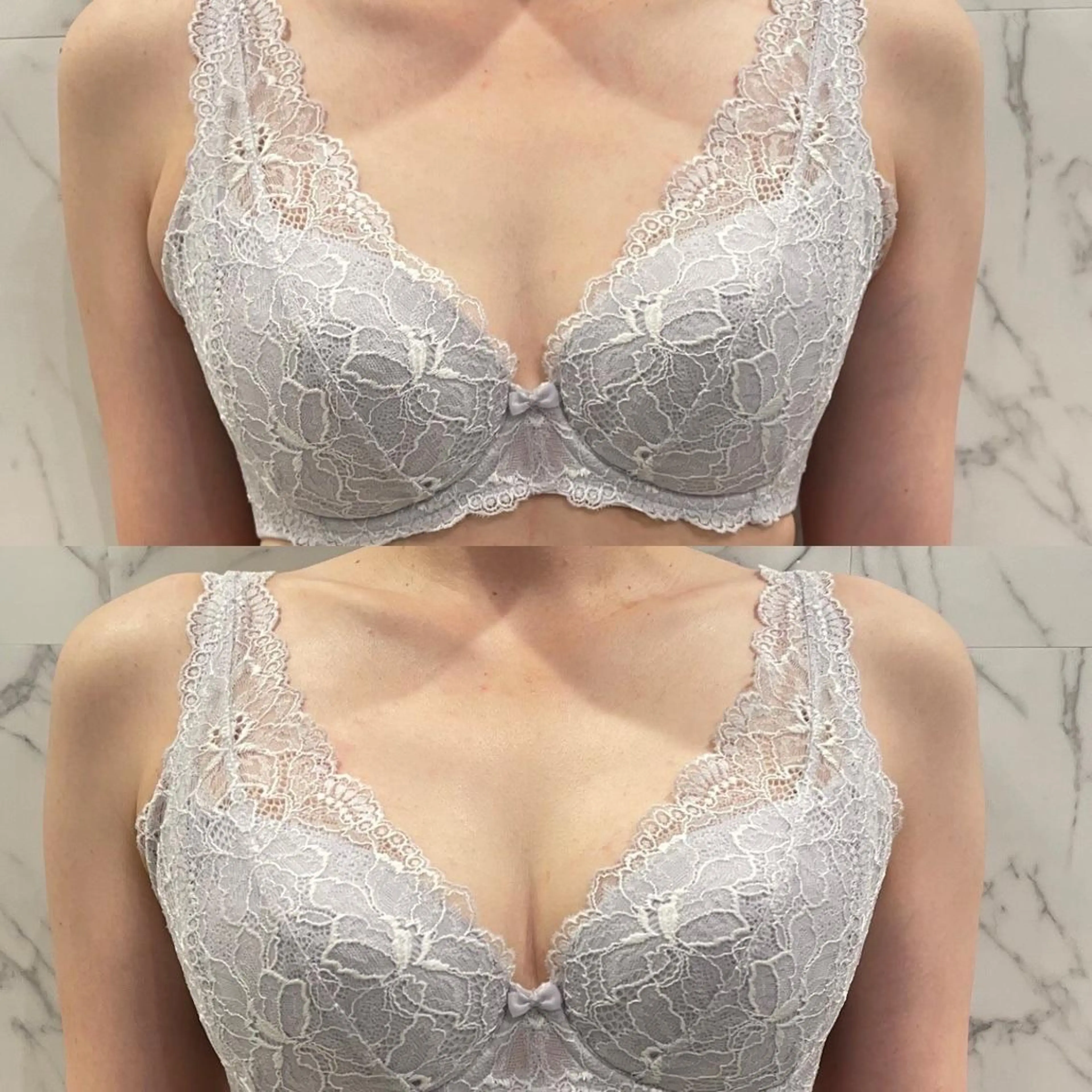 NINEバストアップ施術♪ラジオ波＋EMS＋ハンド！デコルテまでたっぷり施術でフワフワバストに！の写真