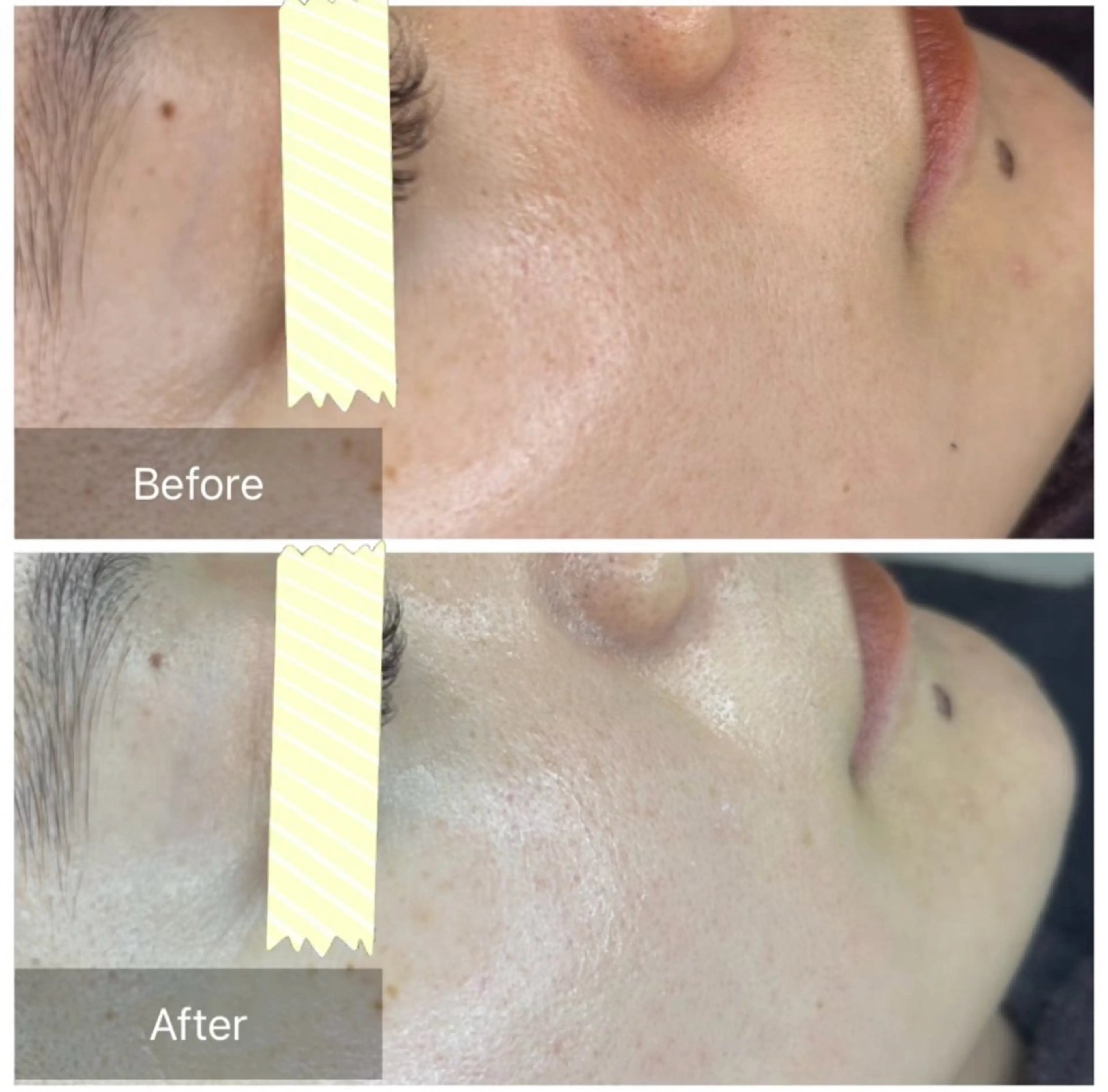 エステ トータルしみケア専門 NICA(ニカ)のエステ・リラクイメージ