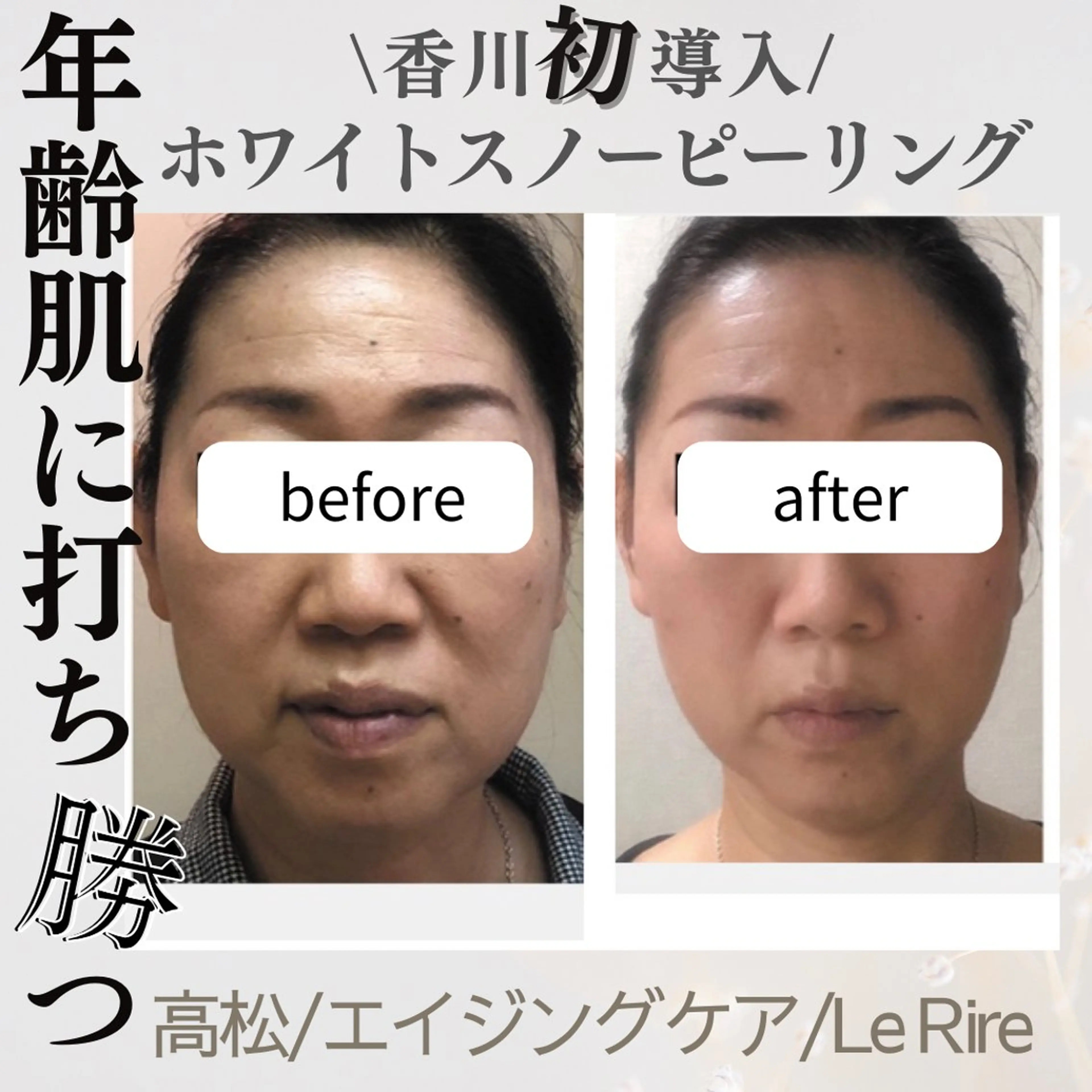 エステ プライベートサロンLe Rire【ルリール】所属・美肌•小顔サロン ルリールのエステ・リラクイメージ