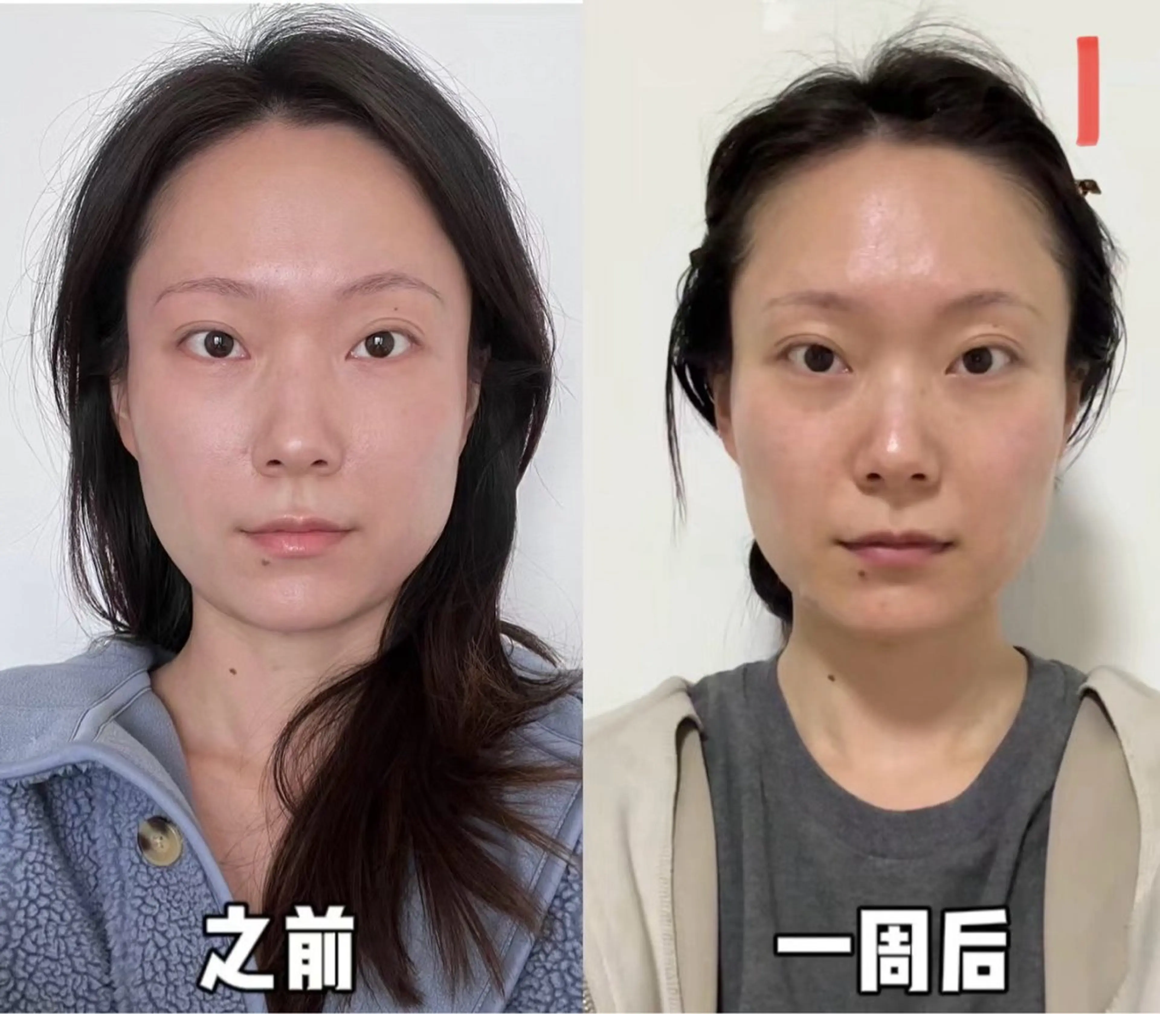 マツエク・マツパ エステ aliaハイフ&水光ジェットサロン所属・aliaハーブ水光店 エステティシャン募集のエステ・リラクイメージ