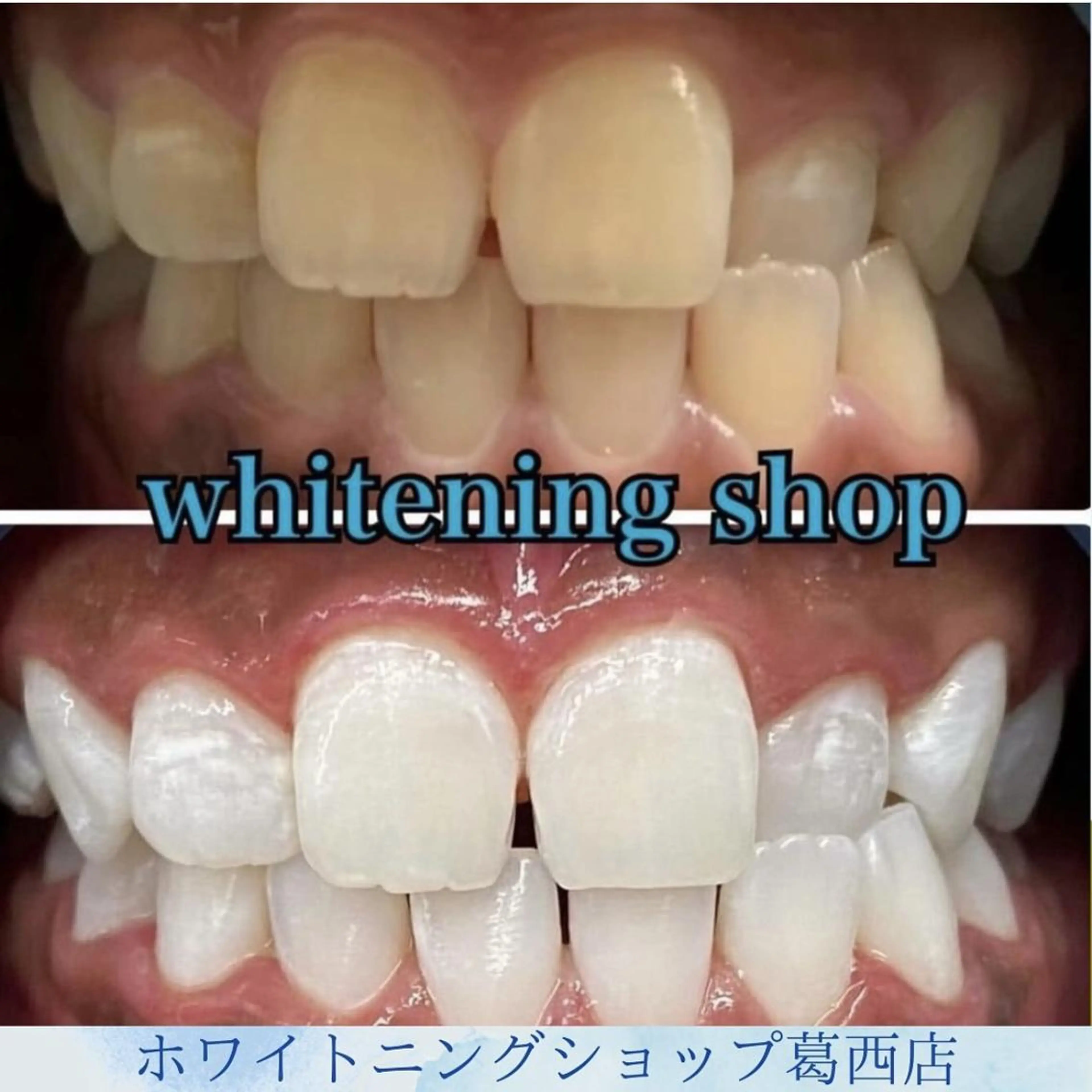 ホワイトニング ショップ葛西店のその他イメージ