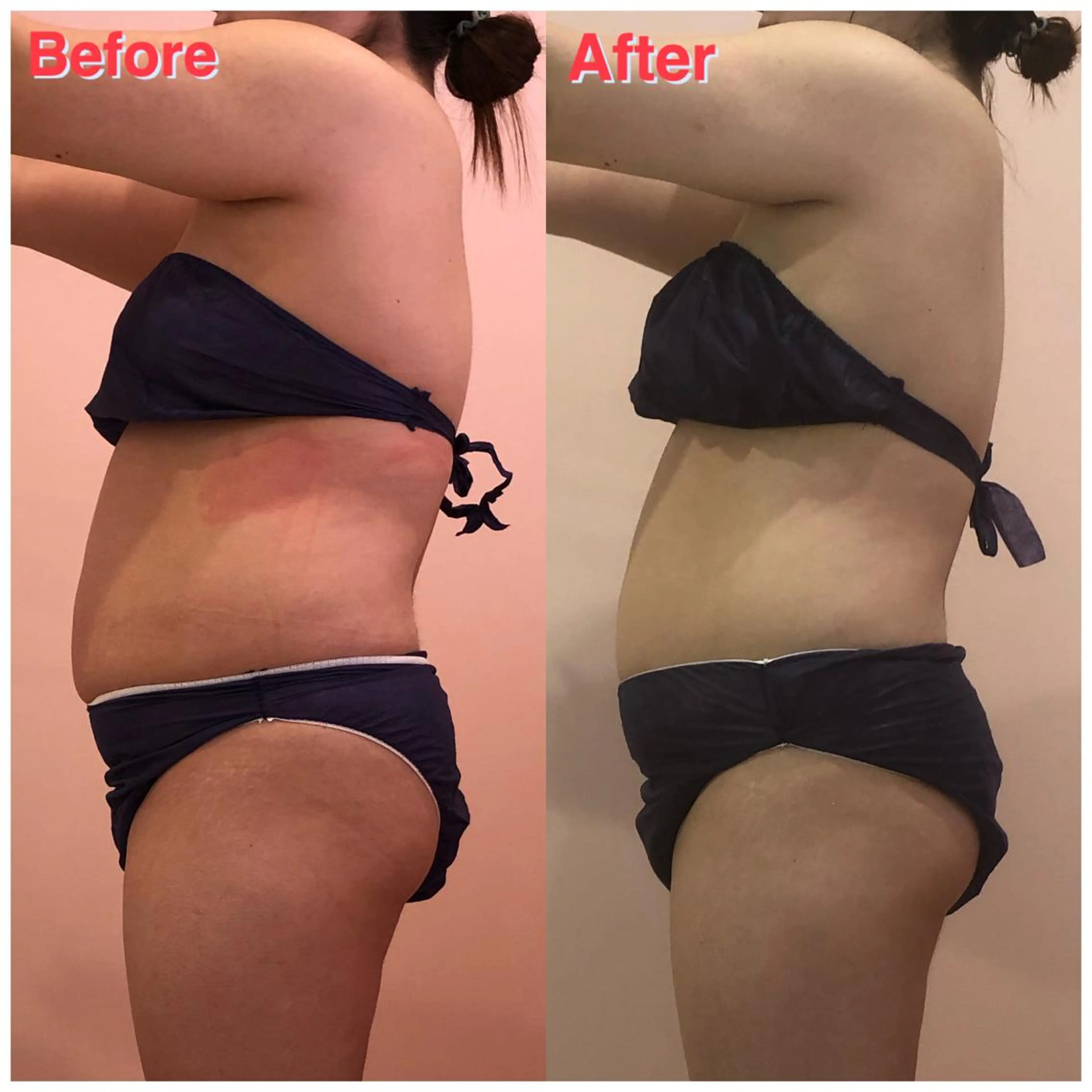 エステサロン　Sブランペタル所属・三沢市エステサロン Sブランペタルのエステ・リラクイメージ