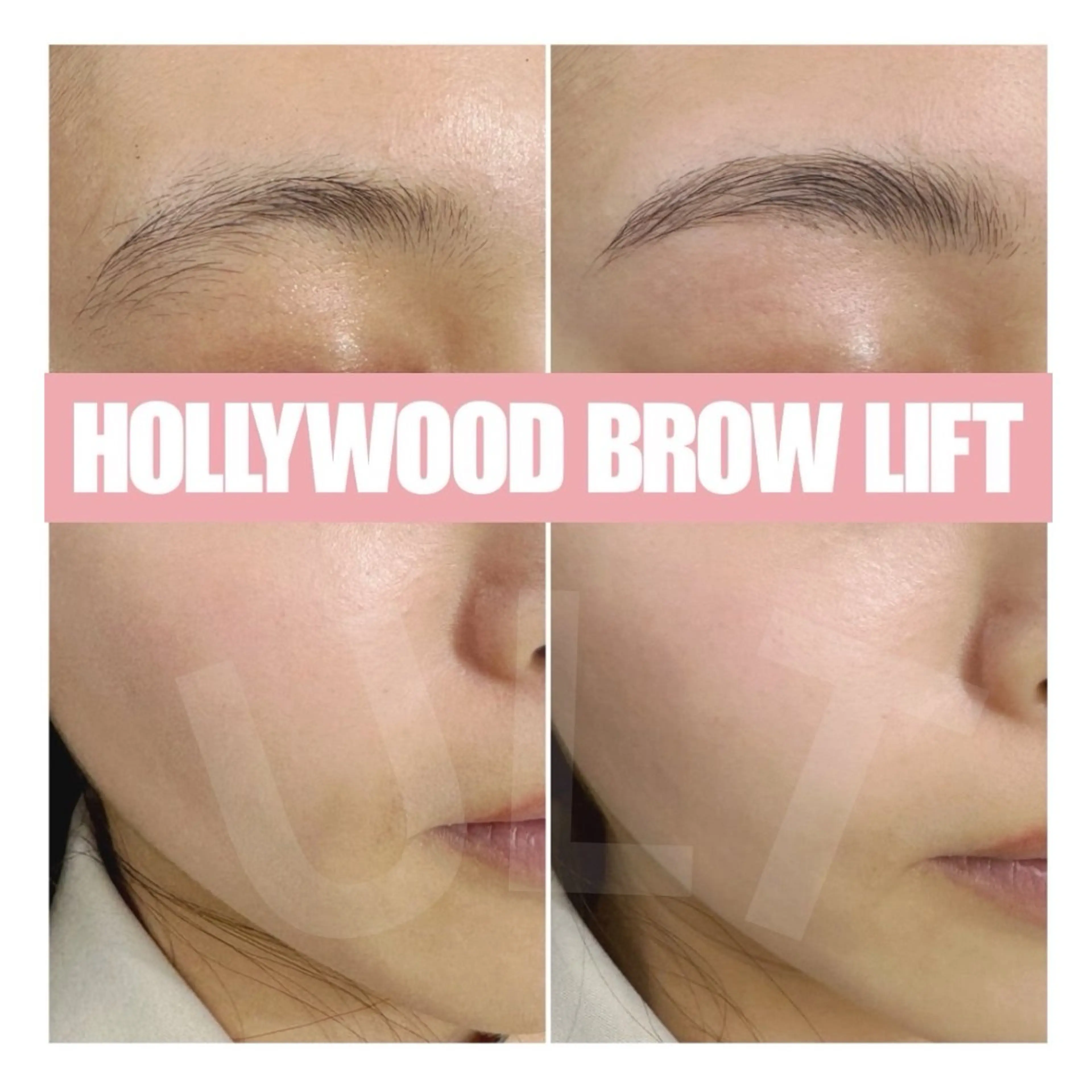 アイブロウ その他(アイブロウ) ULT ultimateskin所属・ULT ウルトのエステ・リラクイメージ