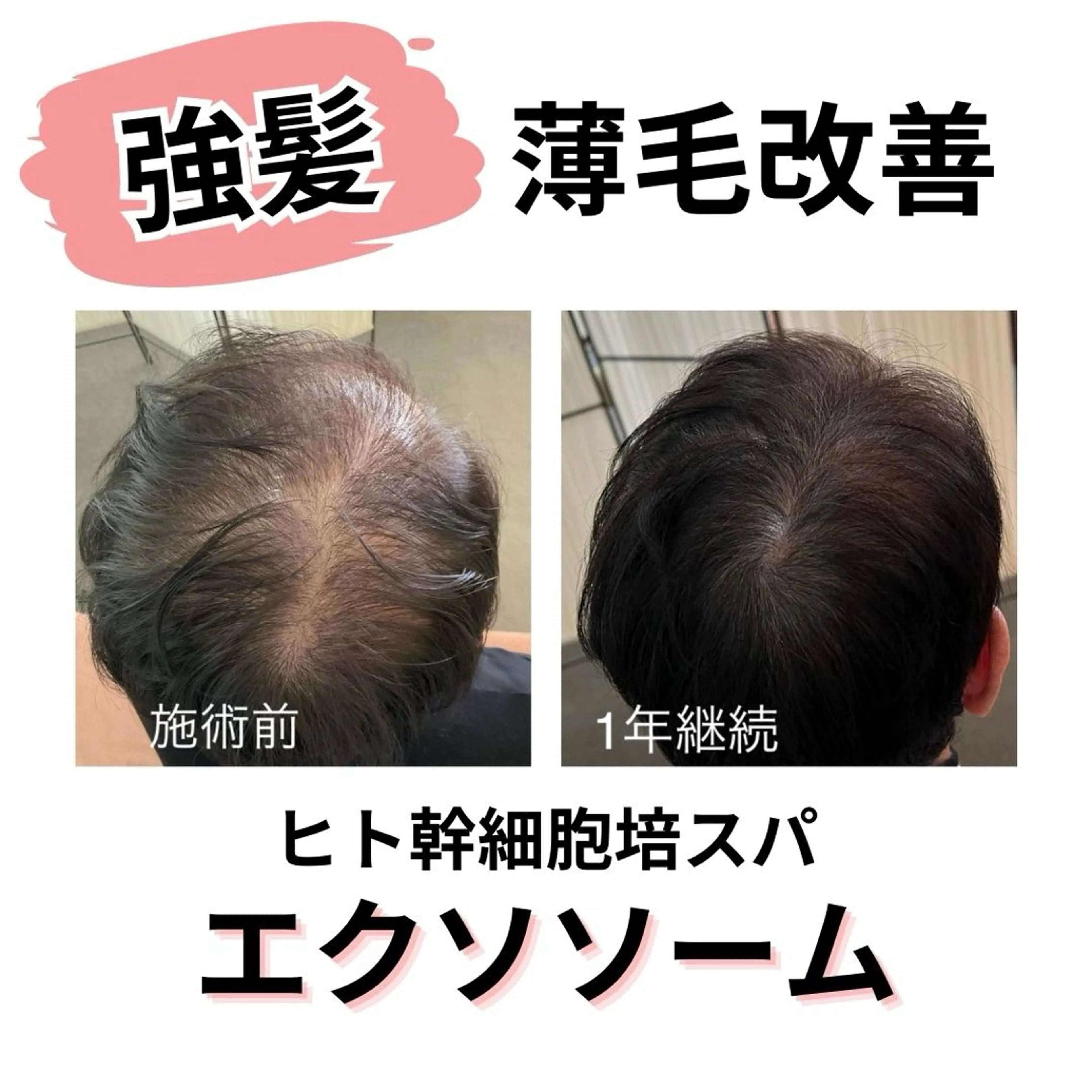 ヒト幹細胞スパ110%の写真