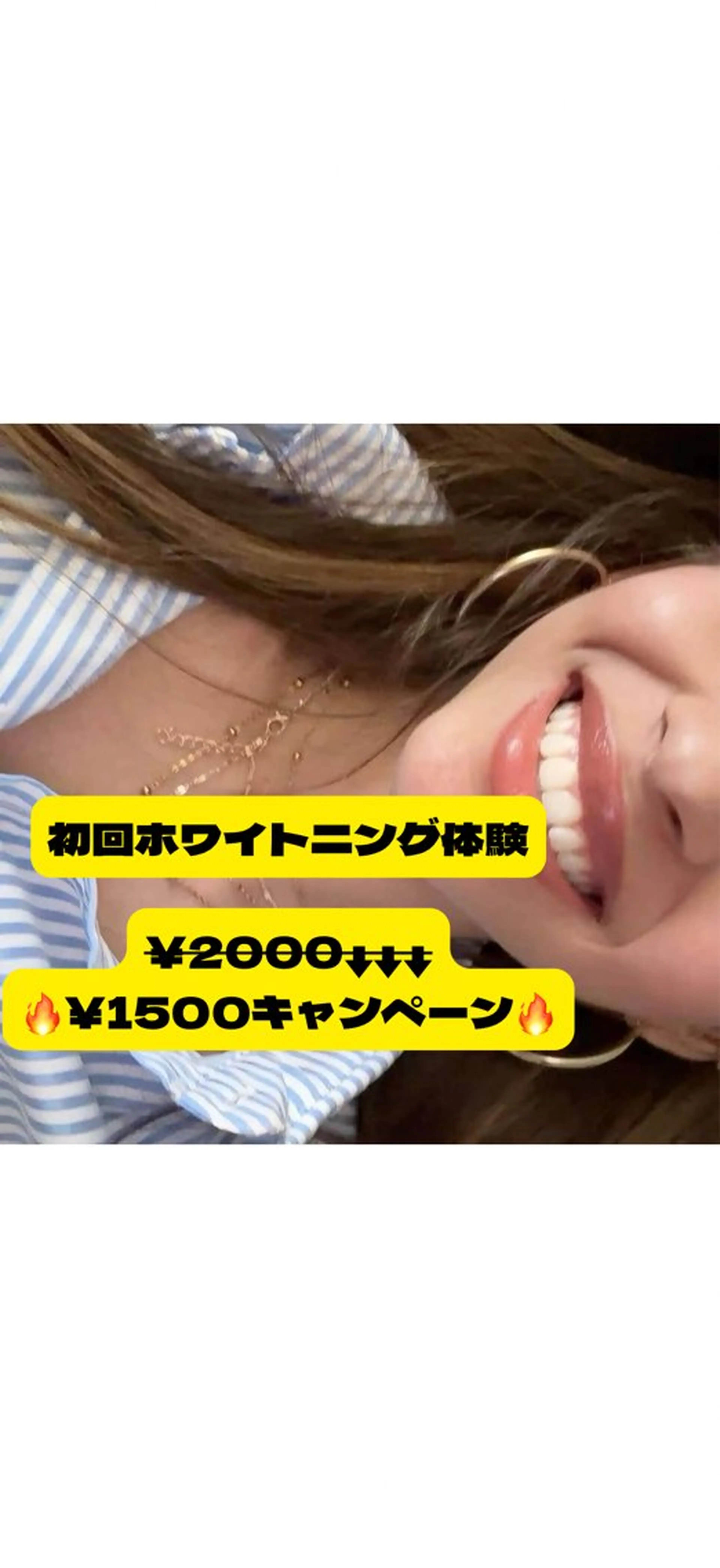 その他 LIBRA自由が丘所属・LIBRA自由が丘 ホワイトニングのその他イメージ