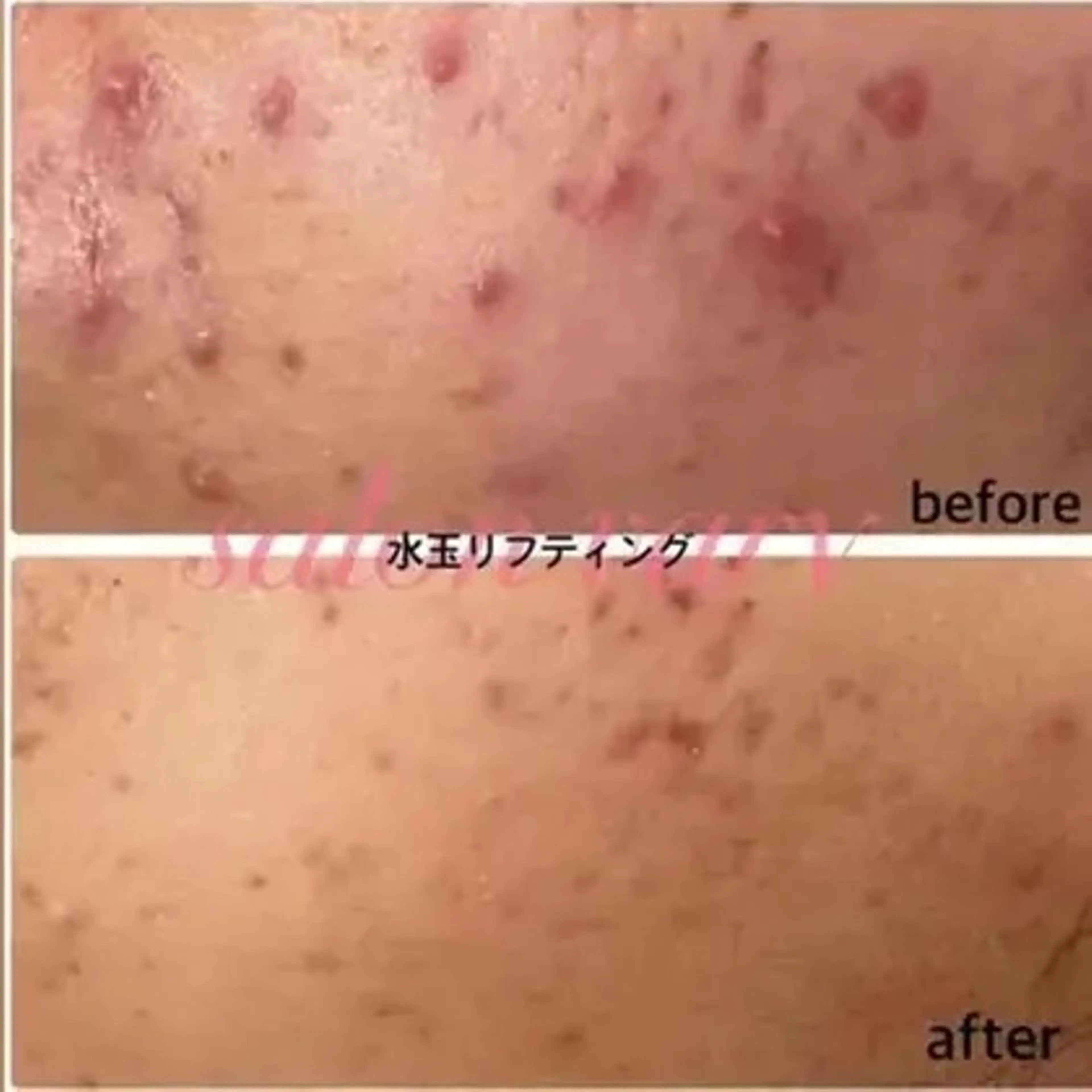 Vary まなみのエステ・リラクイメージ