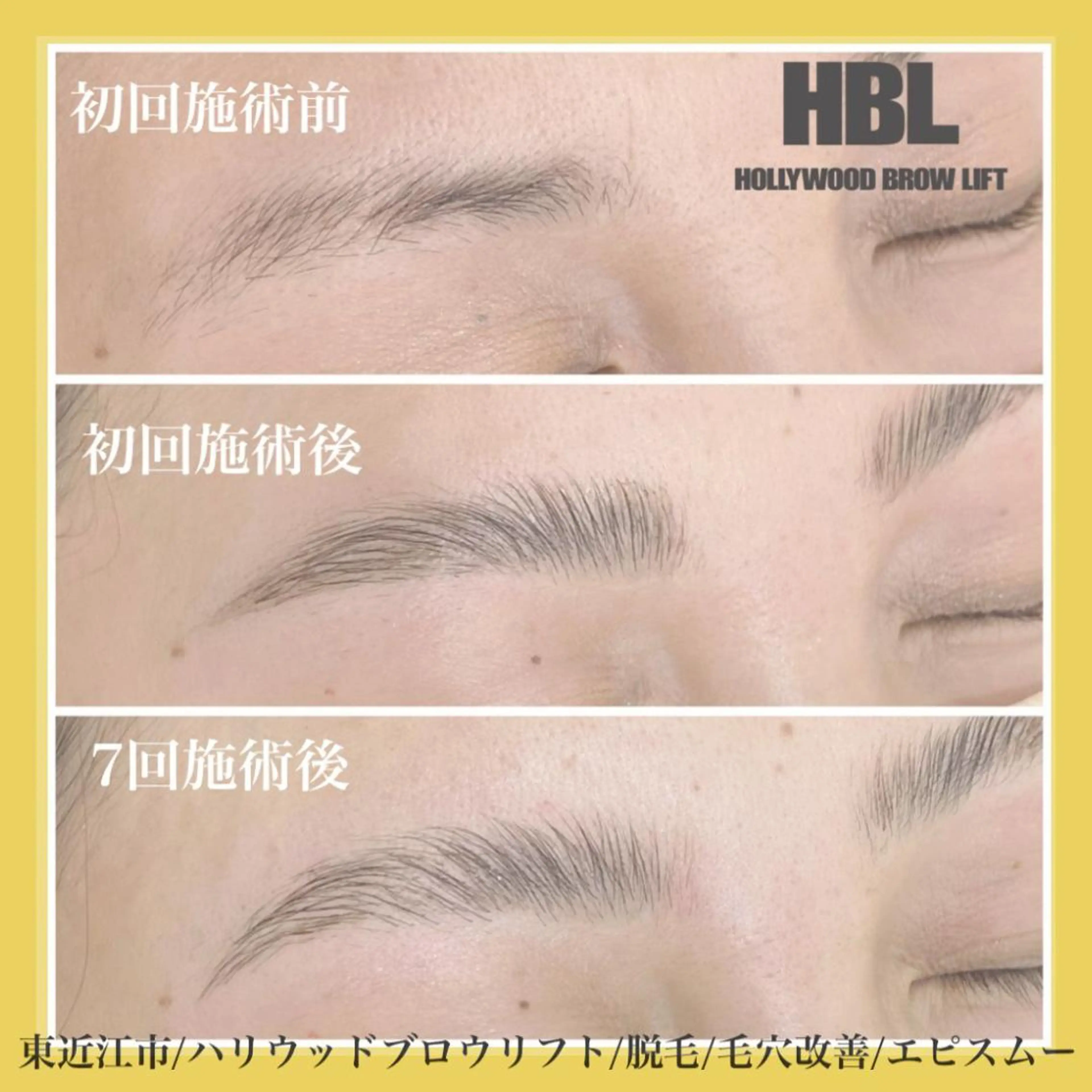 アイブロウ その他(アイブロウ) epismoo 脱毛/HBL/毛穴の眉毛・アイブロウイメージ