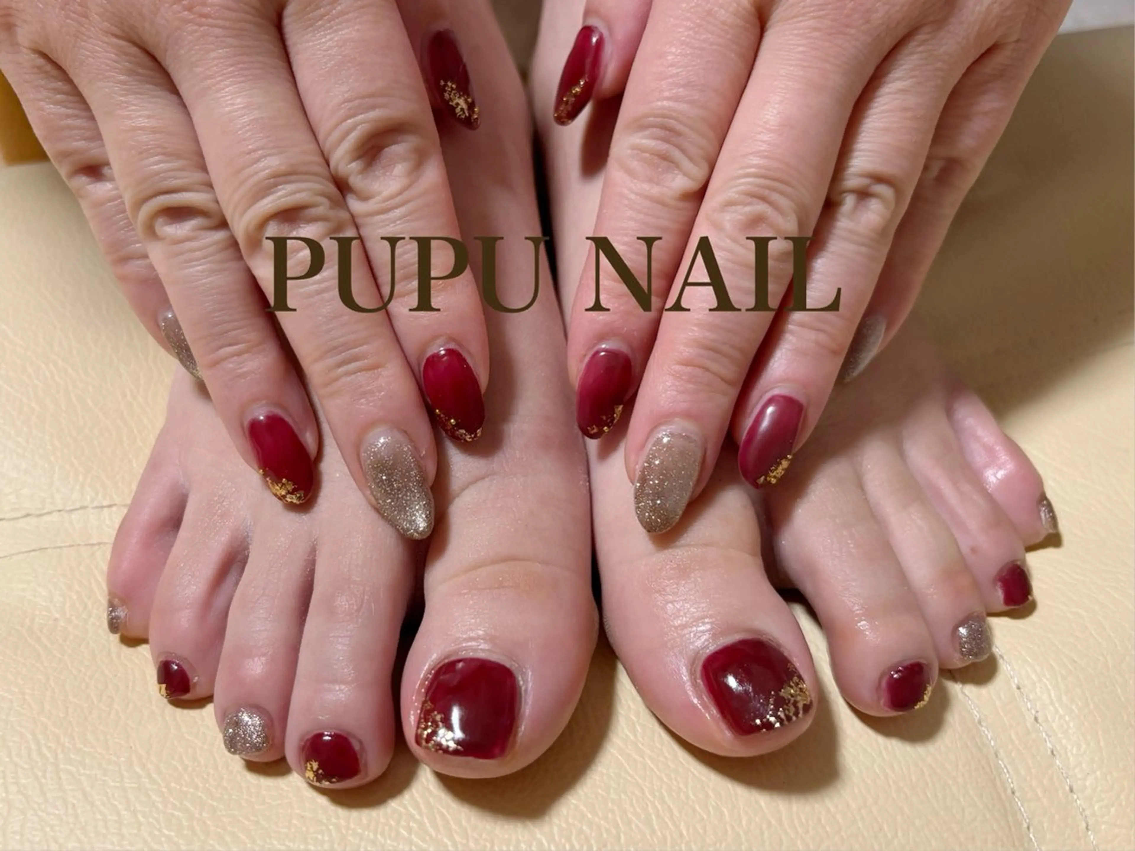 ハンドフット同日施術同じデザインの写真