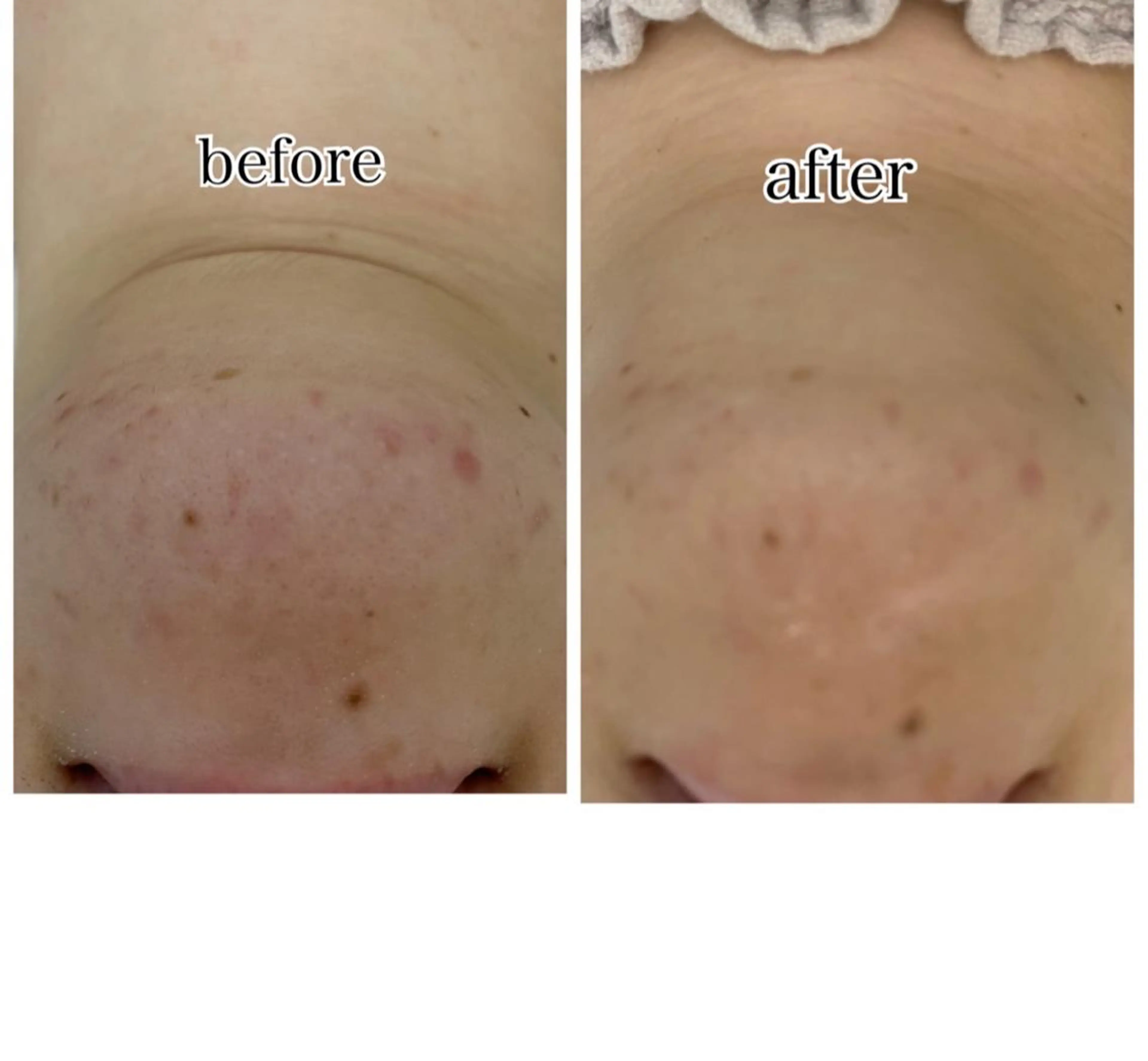 総合エステサロン 肌活のエステ・リラクイメージ