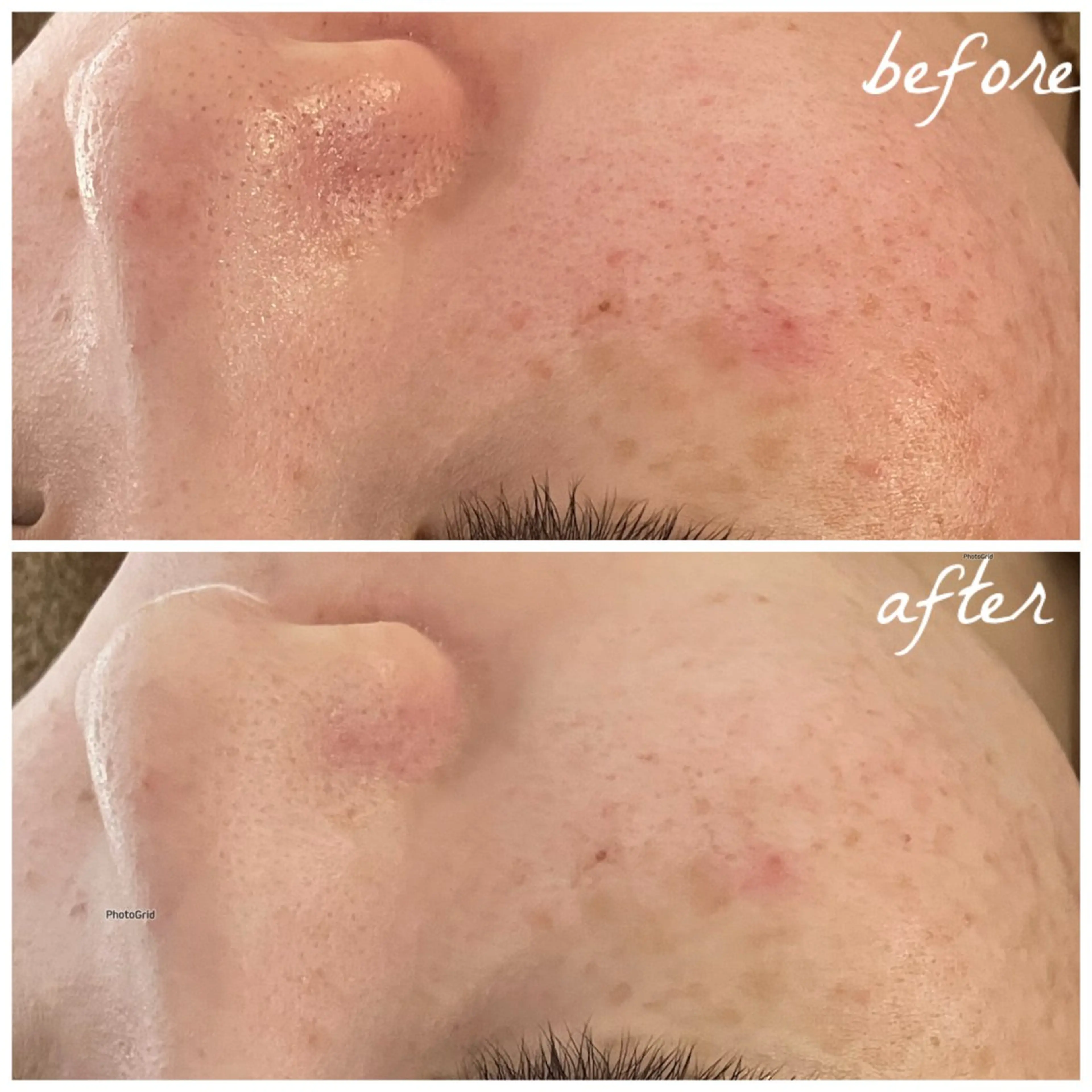 メンズ エステ メナード岐阜市茜部 杉浦のエステ・リラクイメージ